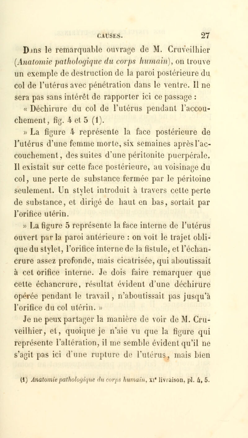 Dms le remarquable ouvrage de M. Cruveilhier (Anatomie pathologique du corps humain), on trouve un exemple de destruction de la paroi postérieure du col de l'utérus avec pénétration dans le ventre. Il ne sera pas sans intérêt de rapporter ici ce passage : « Déchirure du col de l'utérus pendant l'accou- chement, fig. 4 et 5 (1). » La figure 4 représente la face postérieure de l'utérus d'une femme morte, six semaines après l'ac- couchement , des suites d'une péritonite puerpérale. Il existait sur cette face postérieure, au voisinage du col, une perte de substance fermée par le péritoine seulement. Un stylet introduit à travers cette perte de substance, et dirigé de haut en bas, sortait par l'orifice utérin. » La figure 5 représente la face interne de l'utérus ouvert par la paroi antérieure : on voit le trajet obli- que du stylet, l'orifice interne de la fistule, et l'échan- crure assez profonde, mais cicatrisée, qui aboutissait à cet orifice interne. Je dois faire remarquer que cette échancrure, résultat évident d'une déchirure opérée pendant le travail, n'aboutissait pas jusqu'à l'orifice du col utérin. » Je ne peux partager la manière de voir de M. Cru- veilhier, et, quoique je n'aie vu que la figure qui représente l'altération, il me semble évident qu'il ne s'agit pas ici d'une rupture de l'utérus, mais bien (1) Anatomie pathologique du corps humain, kl* livraison, pi. 6, 5.