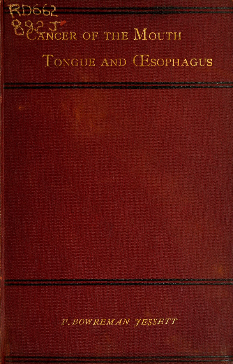 op S 3 CANCER OF THE M OUT N G T.JE A N D lit SOPH AGUS iW»WiW^<«iiW)i»ii»ill»i|i»HM»WMM^ |»TH>^WW»Ml*l1WtWW»l^iWlWS>*')' tMKfSlmS/i'k '',.■','■'■'.';• 'ill ■;['-''/Mi-<.<•■ F, BOW REMAN JESSETT