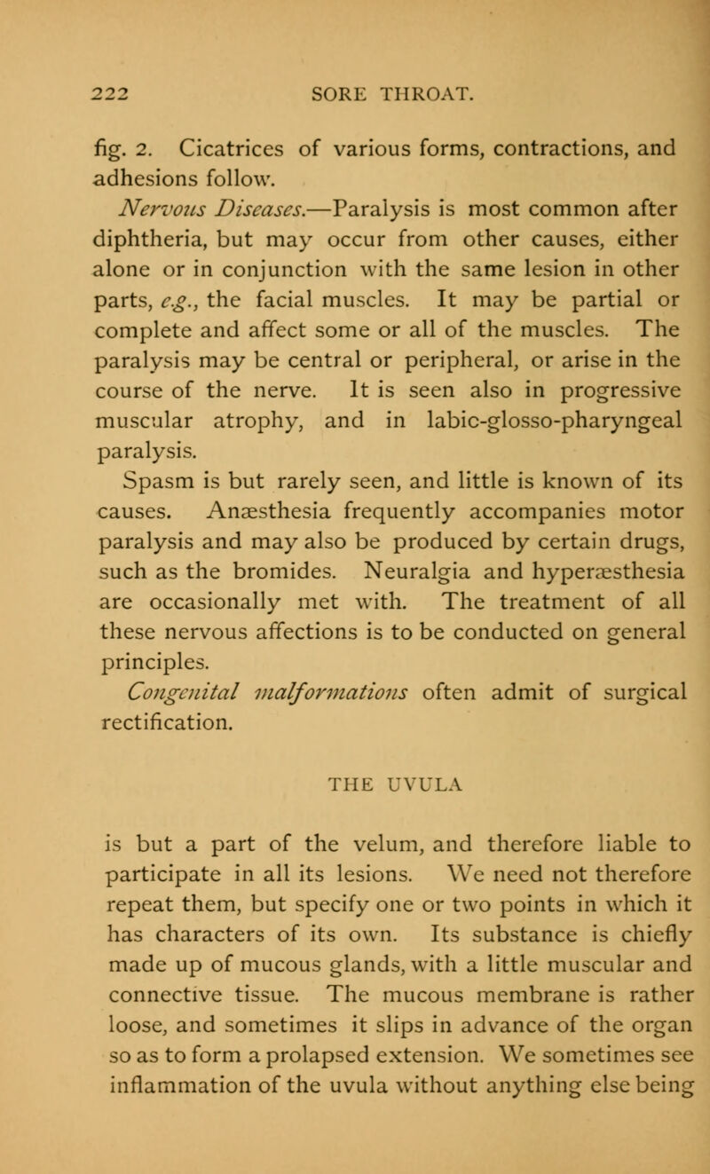 fig. 2. Cicatrices of various forms, contractions, and adhesions follow. Nervous Diseases.—Paralysis is most common after diphtheria, but may occur from other causes, either alone or in conjunction with the same lesion in other parts, e.g., the facial muscles. It may be partial or complete and affect some or all of the muscles. The paralysis may be central or peripheral, or arise in the course of the nerve. It is seen also in progressive muscular atrophy, and in labic-glosso-pharyngeal paralysis. Spasm is but rarely seen, and little is known of its causes. Anaesthesia frequently accompanies motor paralysis and may also be produced by certain drugs, such as the bromides. Neuralgia and hyperesthesia are occasionally met with. The treatment of all these nervous affections is to be conducted on general principles. Congenital malformations often admit of surgical rectification. THE UVULA is but a part of the velum, and therefore liable to participate in all its lesions. We need not therefore repeat them, but specify one or two points in which it has characters of its own. Its substance is chiefly made up of mucous glands, with a little muscular and connective tissue. The mucous membrane is rather loose, and sometimes it slips in advance of the organ so as to form a prolapsed extension. We sometimes see inflammation of the uvula without anything else being