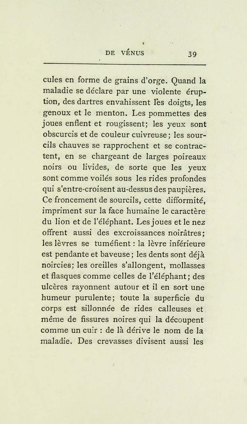 cules en forme de grains d'orge. Quand la maladie se déclare par une violente érup- tion, des dartres envahissent l'es doigts, les genoux et le menton. Les pommettes des joues enflent et rougissent; les yeux sont obscurcis et de couleur cuivreuse; les sour- cils chauves se rapprochent et se contrac- tent, en se chargeant de larges poireaux noirs ou livides, de sorte que les yeux sont comme voilés sous les rides profondes qui s'entre-croisent au-dessus des paupières. Ce froncement de sourcils, cette difformité, impriment sur la face humaine le caractère du lion et de l'éléphant. Les joues et le nez offrent aussi des excroissances noirâtres; les lèvres se tuméfient : la lèvre inférieure est pendante et baveuse; les dents sont déjà noircies; les oreilles s'allongent, mollasses et flasques comme celles de l'éléphant; des ulcères rayonnent autour et il en sort une humeur purulente; toute la superficie du corps est sillonnée de rides calleuses et même de fissures noires qui la découpent comme un cuir : de là dérive le nom de la maladie. Des crevasses divisent aussi les