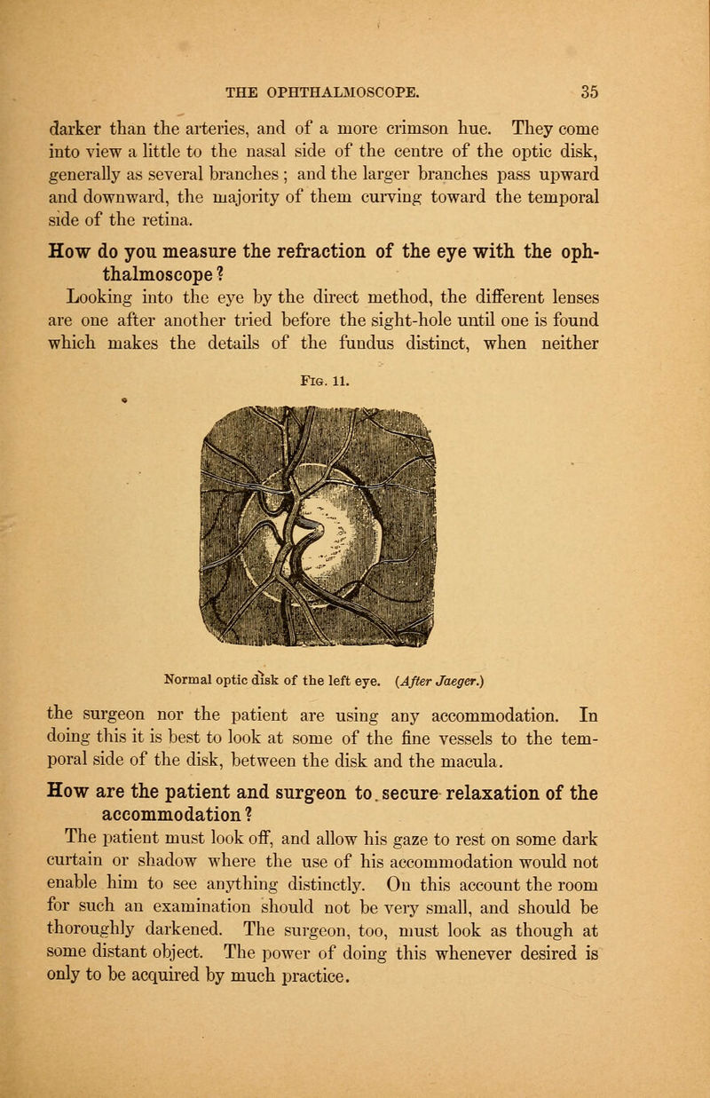 darker than the arteries, and of a more crimson hue. They come into view a little to the nasal side of the centre of the optic disk, generally as several branches ; and the larger branches pass upward and downward, the majority of them curving toward the temporal side of the retina. How do you measure the refraction of the eye with the oph- thalmoscope ? Looking into the eye by the direct method, the different lenses are one after another tried before the sight-hole until one is found which makes the details of the fundus distinct, when neither Fig. 11. Normal optic disk of the left eye. (After Jaeger.) the surgeon nor the patient are using any accommodation. In doing this it is best to look at some of the fine vessels to the tem- poral side of the disk, between the disk and the macula. How are the patient and surgeon to. secure relaxation of the accommodation ? The patient must look off, and allow his gaze to rest on some dark curtain or shadow where the use of his accommodation would not enable him to see anything distinctly. On this account the room for such an examination should not be very small, and should be thoroughly darkened. The surgeon, too, must look as though at some distant object. The power of doing this whenever desired is only to be acquired by much practice.