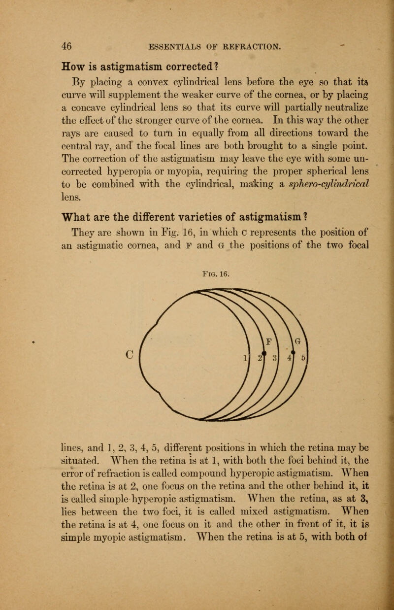 How is astigmatism corrected? By placing a convex cylindrical lens before the eye so that its curve will supplement the weaker curve of the cornea, or by placing a concave cylindrical lens so that its curve will partially neutralize the effect of the stronger curve of the cornea. In this way the other rays are caused to turn in equally from all directions toward the central ray, and the focal lines are both brought to a single point. The correction of the astigmatism may leave the eye with some un- corrected hyperopia or myopia, requiring the proper spherical lens to be combined with the cylindrical, ma'king a sphero-qjlindrical lens. What are the different varieties of astigmatism ? They are shown in Fig. 16, in which c represents the position of an astigmatic cornea, and F and G the positions of the two focal Fig. 16. lines, and 1, 2, 3, 4, 5, different positions in which the retina maybe situated. When the retina is at 1, with both the foci behind it, the error of refraction is called compound hyperopic astigmatism. When the retina is at 2, one focus on the retina and the other behind it, it is called simple hyperopic astigmatism. When the retina, as at 3, lies between the two foci, it is called mixed astigmatism. When the retina is at 4, one focus on it and the other in front of it, it is simple myopic astigmatism. When the retina is at 5, with both of