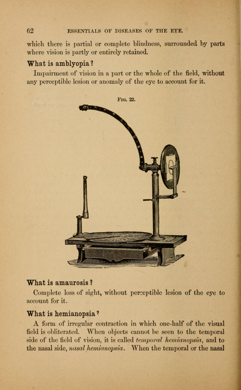 which there is partial or complete blindness, surrounded by parts where vision is partly or entirely retained. What is amblyopia ? Impairment of vision in a part or the whole of the field, without any perceptible lesion or anomaly of the eye to account for it. Fig. 22. What is amaurosis ? Complete loss of sight, without perceptible lesion of the eye to account for it. What is hemianopsia? A form of irregular contraction in which one-half of the visual field is obliterated. When objects cannot be seen to the temporal side of the field of vision, it is called temporal hemianopsia, and to the nasal side, nasal hemianopsia. When the temporal or the nasal