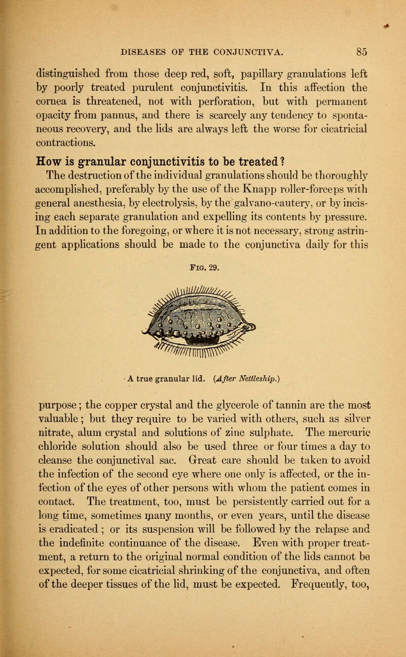 distinguished from those deep red, soft, papillary granulations left by poorly treated purulent conjunctivitis. In this affection the cornea is threatened, not with perforation, but with permanent opacity from pannus, and there is scarcely any tendency to sponta- neous recovery, and the lids are always left the worse for cicatricial contractions. How is granular conjunctivitis to be treated? The destruction of the individual granulations should be thoroughly accomplished, preferably by the use of the Knapp roller-forceps with general anesthesia, by electrolysis, by the galvano-cautery, or by incis- ing each separate granulation and expelling its contents by pressure. In addition to the foregoing, or where it is not necessary, strong astrin- gent applications should be made to the conjunctiva daily for this Fig. 29. • A true granular lid. {After Nettleship.) purpose; the copper crystal and the glycerole of tannin are the most valuable ; but they require to be varied with others, such as silver nitrate, alum crystal and solutions of zinc sulphate. The mercuric chloride solution should also be used three or four times a day to cleanse the conjunctival sac. Great care should be taken to avoid the infection of the second eye where one only is affected, or the in- fection of the eyes of other persons with whom the patient comes in contact. The treatment, too, must be persistently carried out for a long time, sometimes many months, or even years, until the disease is eradicated ; or its suspension will be followed by the relapse and the indefinite continuance of the disease. Even with proper treat- ment, a return to the original normal condition of the lids cannot be expected, for some cicatricial shrinking of the conjunctiva, and often of the deeper tissues of the lid, must be expected. Frequently, too,