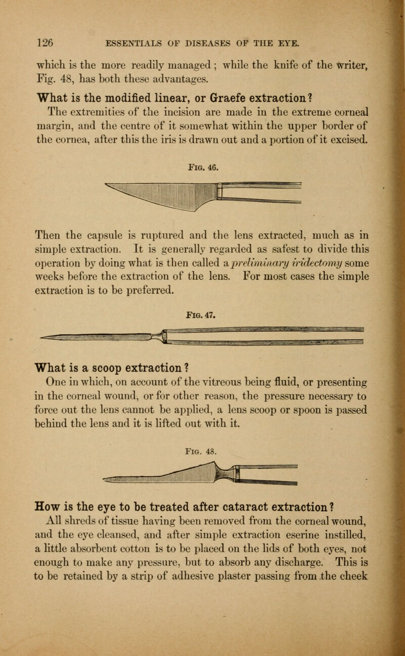 which is the more readily managed ; while the knife of the writer, Fig. 48, has both these advantages. What is the modified linear, or Graefe extraction? The extremities of the incision are made in the extreme corneal margin, and the centre of it somewhat within the upper border of the cornea, after this the iris is drawn out and a portion of it excised. Fig. 46. Then the capsule is ruptured and the lens extracted, much as in simple extraction. It is generally regarded as safest to divide this operation by doing what is then called a preliminary iridectomy some weeks before the extraction of the lens. For most cases the simple extraction is to be preferred. Fig. 47. What is a scoop extraction ? One in which, on account of the vitreous being fluid, or presenting in the corneal wound, or for other reason, the pressure necessary to force out the lens cannot be applied, a lens scoop or spoon is passed behind the lens and it is lifted out with it. How is the eye to be treated after cataract extraction? All shreds of tissue having been removed from the corneal wound, and the eye cleansed, and after simple extraction eserine instilled, a little absorbent cotton is to be placed on the lids of both ejTes, not enough to make any pressure, but to absorb any discharge. This is to be retained by a strip of adhesive plaster passing from the cheek