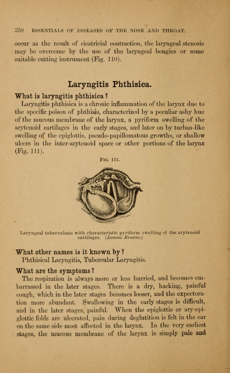 occur as the result of cicatricial contraction, the laryngeal stenosis may be overcome by the use of the laryngeal bougies or some suitable cutting instrument (Fig. 110). Laryngitis Phthisica. What is laryngitis phthisica ? Laryngitis phthisica is a chronic inflammation of the larynx due to the specific poison of phthisis, characterized by a peculiar ashy hue of the mucous membrane of the larynx, a pyriform swelling of the arytenoid cartilages in the early stages, and later on by turban-like swelling of the epiglottis, pscudo-papillomatous growths, or shallow ulcers in the inter-arytenoid space or other portions of the larynx (Fig. 111). Fig. 111. Laryngeal tuberculosis with characteristic pyriform swelling of the arytenoid cartilages. (Lennox Browne.) What other names is it known by ? Phthisical Laryngitis, Tubercular Laryngitis. What are the symptoms ? The respiration is always more or less hurried, and becomes em- barrassed in the later stages. There is a dry, hacking, painful cough, which in the later stages becomes looser, and the expectora- tion more abundant. Swallowing in the early stages is difficult, and in the later stages, painful. When the epiglottis or ary-epi- glottic folds are ulcerated, pain during deglutition is felt in the ear on the same side most affected in the larynx. In the very earliest stages, the mucous membrane of the larynx is simply pale and