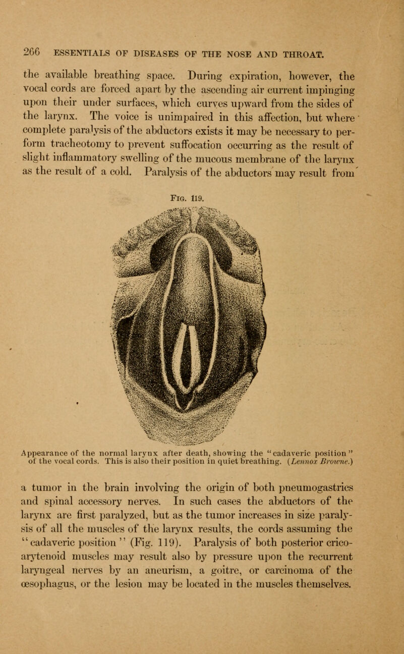 the available breathing space. During expiration, however, the vocal cords are forced apart by the ascending air current impinging upon their under surfaces, which curves upward from the sides of the larynx. The voice is unimpaired in this affection, but where complete paralysis of the abductors exists it may be necessary to per- form tracheotomy to prevent suffocation occurring as the result of slight inflammatory swelling of the mucous membrane of the larynx as the result of a cold. Paralysis of the abductors may result from' Appearance of the normal larynx after death, showing the cadaveric position of the vocal cords. This is also their position in quiet breathing. {Lennox Browne.) a tumor in the brain involving the origin of both pneumogastrics and spinal accessory nerves. In such cases the abductors of the larynx are first paralyzed, but as the tumor increases in size paraly- sis of all the muscles of the larynx results, the cords assuming the ''cadaveric position  (Fig. 119). Paralysis of both posterior crico- arytenoid muscles may result also by pressure upon the recurrent laryngeal nerves by an aneurism, a goitre, or carcinoma of the oesophagus, or the lesion may be located in the muscles themselves.