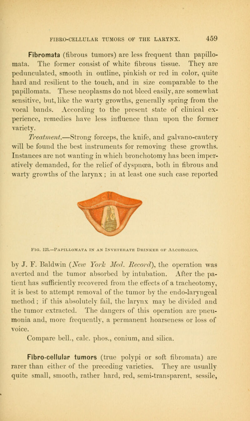 Fibromata (fibrous tumors) are less frequent than papillo- mata. The former consist of white fibrous tissue. They are pedunculated, smooth in outline, pinkish or red in color, quite hard and resilient to the touch, and in size comparable to the papillomata. These neoplasms do not bleed easily, are somewhat sensitive, but, like the warty growths, generally spring from the vocal bands. According to the present state of clinical ex- perience, remedies have less influence than upon the former variety. Treatment.—Strong forceps, the knife, and galvano-cautery will be found the best instruments for removing these growths. Instances are not wanting in which bronchotomy has been imper- atively demanded, for the relief of dyspnoea, both in fibrous and warty growths of the larynx; in at least one such case reported Fig. 123.—Papillomata in an Inveterate Drinker of Alcoholics. by J. F. Baldwin {Neic Yorh Med. Record), tlie operation was averted and the tumor absorbed by intubation. After the pa- tient has sufficiently recovered from the effects of a tracheotomy, it is best to attempt removal of the tumor by the endo-laryngeal method; if tliis absolutely fail, the larynx may be divided and the tumor extracted. The dangers of tliis operation are j)neu- monia and, more frequently, a permanent Jioarseness or loss of voice. Compare bell., cak:. plios., conium, and silica. Fibro-cellular tumors (true polypi or soft fibromata) are rarer than either of the preceding varieties. They are usually quite small, smootli, rather hard, red, semi-transparent, sessile,