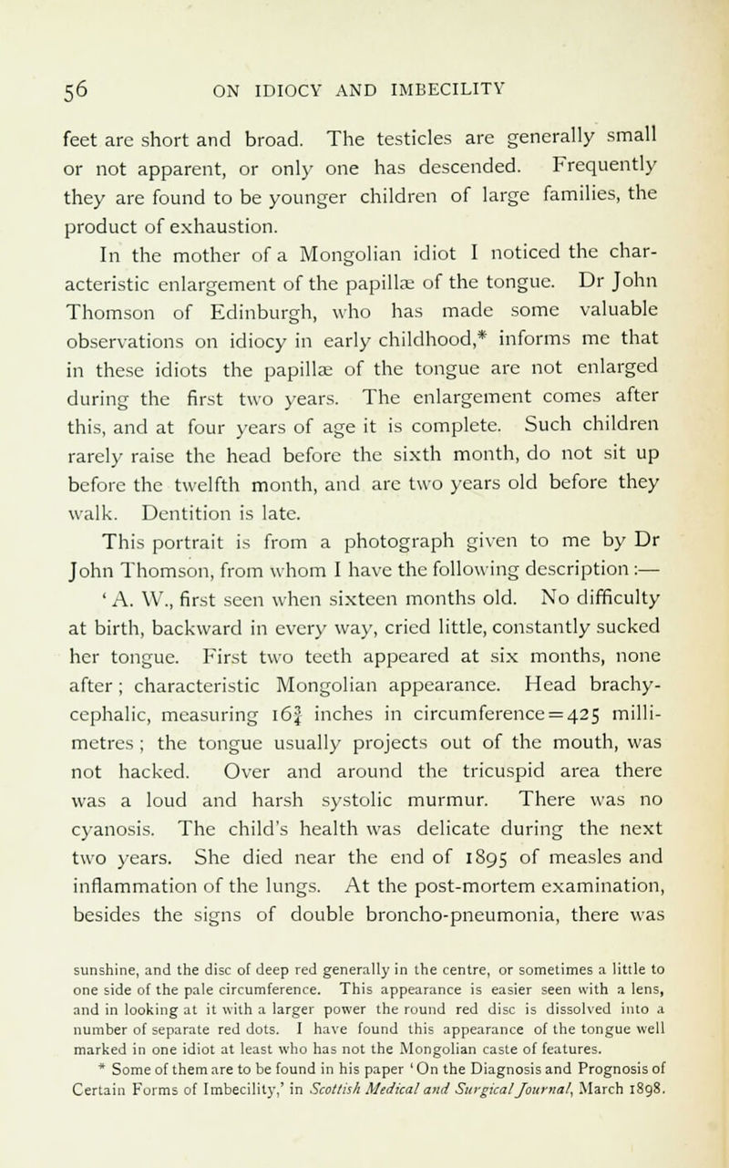 feet are short and broad. The testicles are generally small or not apparent, or only one has descended. Frequently they are found to be younger children of large families, the product of exhaustion. In the mother of a Mongolian idiot I noticed the char- acteristic enlargement of the papillae of the tongue. Dr John Thomson of Edinburgh, who has made some valuable observations on idiocy in early childhood,* informs me that in these idiots the papillae of the tongue are not enlarged during the first two years. The enlargement comes after this, and at four years of age it is complete. Such children rarely raise the head before the sixth month, do not sit up before the twelfth month, and are two years old before they walk. Dentition is late. This portrait is from a photograph given to me by Dr John Thomson, from whom I have the following description :— ' A. W., first seen when sixteen months old. No difficulty at birth, backward in every way, cried little, constantly sucked her tongue. First two teeth appeared at six months, none after; characteristic Mongolian appearance. Head brachy- cephalic, measuring 16J inches in circumference = 425 milli- metres ; the tongue usually projects out of the mouth, was not hacked. Over and around the tricuspid area there was a loud and harsh systolic murmur. There was no cyanosis. The child's health was delicate during the next two years. She died near the end of 1895 of measles and inflammation of the lungs. At the post-mortem examination, besides the signs of double broncho-pneumonia, there was sunshine, and the disc of deep red generally in the centre, or sometimes a little to one side of the pale circumference. This appearance is easier seen with a lens, and in looking at it with a larger power the round red disc is dissolved into a number of separate red dots. I have found this appearance of the tongue well marked in one idiot at least who has not the Mongolian caste of features. * Some of them are to be found in his paper ' On the Diagnosis and Prognosis of Certain Forms of Imbecility,' in Scottish Medical and Surgical Journal, March 1898.