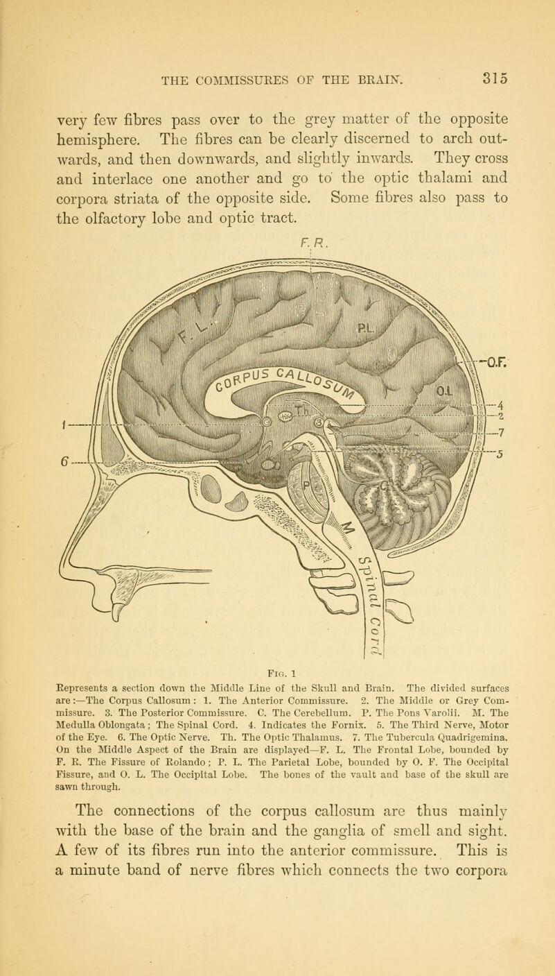 THE COMMISSURES OF THE BRAIN. 31; very few fibres pass over to the grey matter of the opposite hemisphere. The fibres can be clearly discerned to arch out- wards, and then downwards, and slightly inwards. They cross and interlace one another and go to' the optic thalami and corpora striata of the opposite side. Some fibres also pass to the olfactory lobe and optic tract. F.R. \-Q.r: Fig. 1 Represents a section down the Middle Line of the Skull and Brain. The divided surfaces are :—The Corpus Callosum : 1. The Anterior Commissure. 2. The Middle or Grey Com- missure. 3. The Posterior Commissvire. C. The Cerebellum. P. The Pons Varolii. M. The Medulla Oblongata; The Spinal Cord. 4. Indicates the Fornix. 5. The Third Nerve, Motor of the Eye. 6. The Optic Nerve. Th. The Optic Thalamus. 7. The Tubercula Quadrigemina. On the Middle Aspect of the Brain are displayed—F. L. The Frontal Lobe, bounded by P. E. The Fissure of Rolando ; P. L. The Parietal Lobe, bounded by O. F. The Occipital Fissure, aud O. L. The Occipital Lobe. The bones of the vault and base of the skull are sawn through. The connections of the corpus callosum are thus mainly with the base of the brain and the ganglia of smell and sight. A few of its fibres run into the anterior commissure. This is a minute band of nerve fibres which connects the two corpora