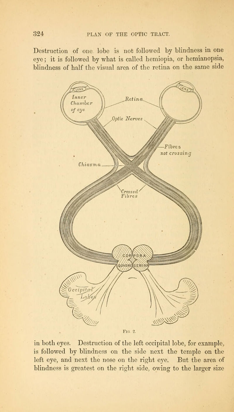 Destruction of one lobe is not followed by blindness in one eye; it is followed by what is called hemiopia, or hemianopsia, blindness of half the visual area of the retina on the same side in both eyes. Destruction of the left occipital lobe, for example, is followed by blindness on the side next the temple on the left eye, and next the nose on the right eye. But the area of blindness is greatest on the right side, owing to the larger size