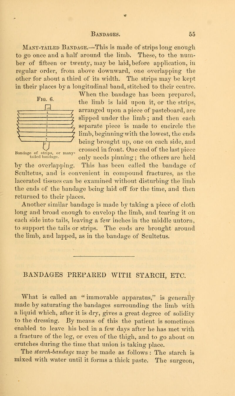 Fig. 6. Many-tailed Bandage.—This is made of strips long enougli to go once and a half around the limb. These, to the num- ber of fifteen or twenty, may be laid, before application, in regular order, from above downward, one overlapping the other for about a third of its width. The strips may be kept in their places by a longitudinal band, stitched to their centre. When the bandage has been prepared, the limb is laid upon it, or the strips, arranged upon a piece of pasteboard, are slipped under the limb ; and then each separate piece is made to encircle the ^ limb, beginning with the lowest, the ends being brought up, one on each side, and crossed in front. One end of the last piece 'tailed bandage.  only uccds pinning; the others are held by the overlapping. This has been called the bandage of Scultetus, and is convenient in compound fractures, as the lacerated tissues can be examined without disturbing the limb the ends of the bandage being laid off for the time, and then returned to their places. Another similar bandage is made by taking a piece of cloth long and broad enough to envelop the limb, and tearing it on each side into tails, leaving a few inches in the middle untorn, to support the tails or strips. The ends are brought around the limb, and lapped, as in the bandage of Scultetus. \ / \ / 'v / > J \ : / \ 7 \ / \ / a Bandage of strips, or many- BAi^DAGES PREPARED WITH STARCH, ETC. What is called an  immovable apparatus, is generally made by saturating the bandages surrounding the limb with a liquid which, after it is dry, gives a great degree of solidity to the dressing, ^j means of this the patient is sometimes enabled to leave his bed in a few days after he has met with a fracture of the leg, or even of the thigh, and to go about on crutches during the time that union is taking place. The starch-bandage may be made as follows : The starch is mixed with water until it forms a thick paste. The surgeon,