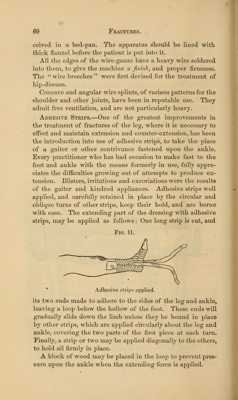 ceived in a bed-pan. The apparatus should be lined with thick flannel before the patient is put into it. All the edges of the wire-ganze have a heavy wire soldered into them, to give the machine a finish, and proper firmness. The  wire breeches  were first devised for the treatment of hip-disease. Concave and angular wire splints, of varions patterns for the shoulder and other joints, have been in reputable use. Thej admit free ventilation, and are not particularly heavy. Adhesive Strips.—One of the greatest improvements in the treatment of fractures of the leg, where it is necessary to effect and maintain extension and counter-extension, has been the introduction into use of adhesive strips, to take the place of a gaiter or other contrivance fastened upon the ankle. Every practitioner who has had occasion to make fast to the foot and ankle with the means formerly in use, fully appre- ciates the difficulties growing out of attempts to produce ex- tension. Blisters, irritations and excoriations were the results of the gaiter and kindred appliances. Adhesive strips well applied, and carefully retained in place by the circular and oblique turns of other strips, keep their hold, and are borne with ease. The extending part of the dressing with adhesive strips, may be applied as follows: One long strip is cut, and Fig. 11. * Adhesive strips applied. its two ends made to adhere to the sides of the leg and ankle, leaving a loop below the hollow of the foot. These ends will gradually slide down the limb unless they be bound in place by other strips, which are applied circularly about the leg and ankle, covering the two parts of the first piece at each turn. Finally, a strip or two may be applied diagonally to the others, to hold all firmly in place. A block of wood may be placed in the loop to prevent pres- sure upon the ankle when the extending force is applied.