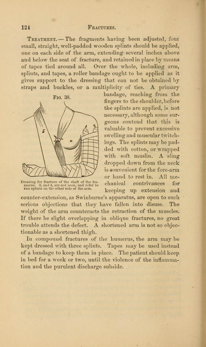 Treatment. — The fragments liaving been adjusted, four small, straight, well-padded wooden splints should be applied, one on each side of the arm, extending several inches above and below the seat of fracture, and retained in place by means of tapes tied around all. Over the whole, including arm, splints, and tapes, a roller bandage ought to be applied as it gives support to the dressing that can not be obtained by straps and buckles, or a multiplicity of ties. A primary the Fig. 38. bandage. reaching from fingers to the shoulder,before tlie splints are applied, is not necessary, although some sur- geons contend that this is valuable to prevent excessive swelling and muscular twitch- iiigs. The splints may be pad- ded with cotton, or wrapped with soft muslin. A sling dropped down from the neck is eonvenient for the fore-arm or hand to rest in. All me- chanical contrivances for keeping up extension and counter-extension, as Swinburne's apparatus, are open to such serious objections that they have fallen into disuse. The weight of the arm counteracts the retraction of the muscles. If there be slight overlapping in oblique fractures, no great trouble attends the defect. A shortened ami is not so objec- tionable as a shortened thigh. In compound fractures of the humerus, the arm may be kept dressed with three splints. Tapes may be used instead of a bandage to keep them in place. The patient should keep in bed for a week or two, until the violence of the inflamma- tion and the purulent discharge subside. Dressing for fracture of the shaft of the hu- merus. 3, and 4, are not seen, and refer to two splints on th'^ other side of the arm.