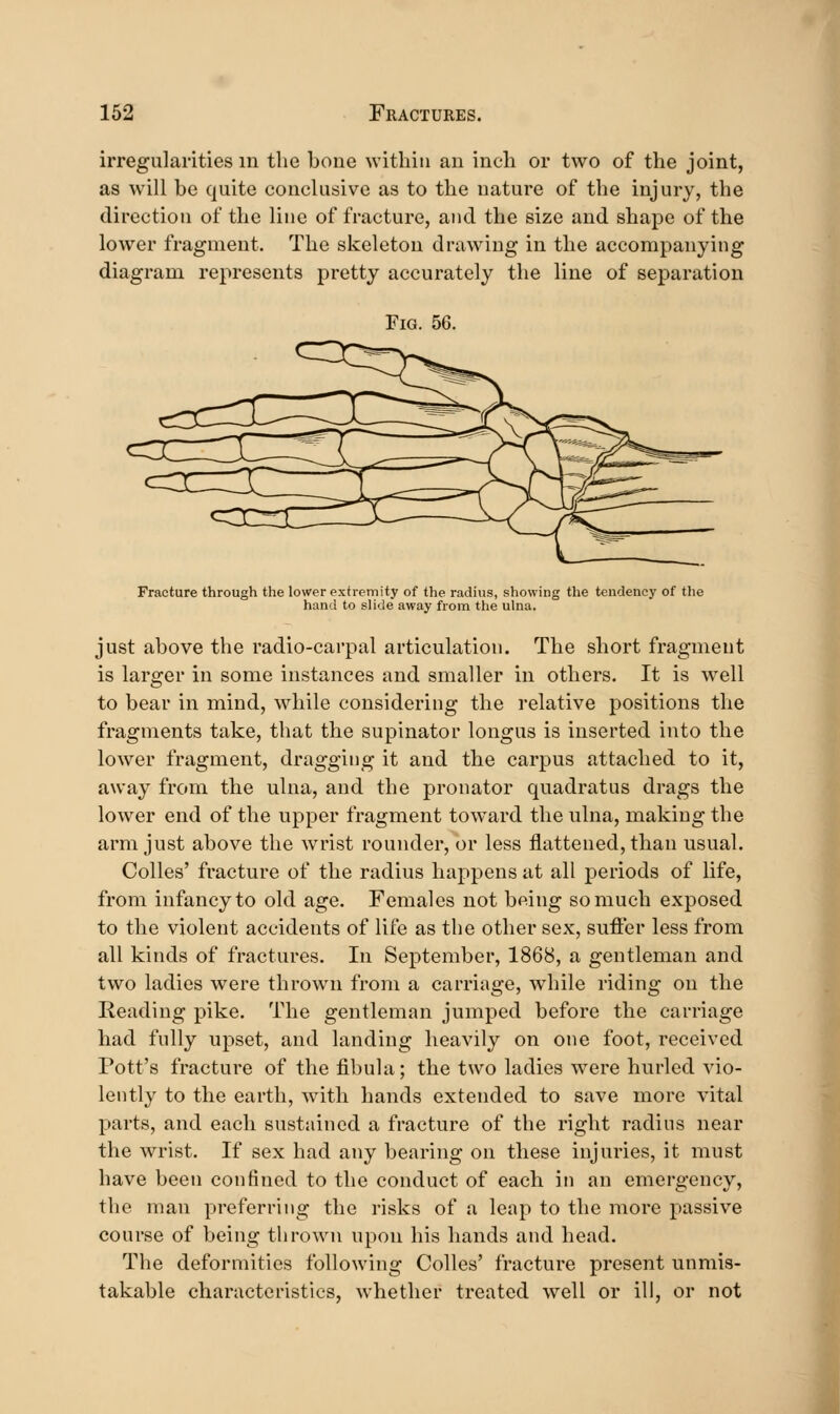 irregularities in the bone within an inch or two of the joint, as will be quite conclusive as to the nature of the injury, the direction of the line of fracture, and the size and shape of the lower fragment. The skeleton drawing in the accompanying diagram represents pretty accurately the line of separation Fig. 56. Fracture through the lower extremity of the radius, showing the tendency of the hand to slide away from the ulna. just above the radio-carpal articulation. The short fragment is larger in some instances and smaller in others. It is w^ell to bear in mind, while considering the relative positions the fragments take, that the supinator longus is inserted into the lower fragment, dragging it and the carpus attached to it, away from the ulna, and the pronator quadratus drags the lower end of the upper fragment toward the ulna, making the arm just above the wrist rounder, or less flattened, than usual. Colles' fracture of the radius happens at all periods of life, from infancy to old age. Females not being so much exposed to the violent accidents of life as the other sex, suffer less from all kinds of fractures. In September, 1868, a gentleman and two ladies were thrown from a carriage, while riding on the Reading pike. The gentleman jumped before the carriage had fully upset, and landing heavily on one foot, received Pott's fracture of the fibula; the two ladies w^ere hurled vio- lently to the earth, with hands extended to save more vital parts, and each sustained a fracture of the right radins near the wrist. If sex had any bearing on these injuries, it must have been confined to the conduct of each in an emergency, the man preferring the risks of a leap to the more passive course of being thrown upon his hands and head. The deformities following Colles' fracture present unmis- takable characteristics, whether treated well or ill, or not