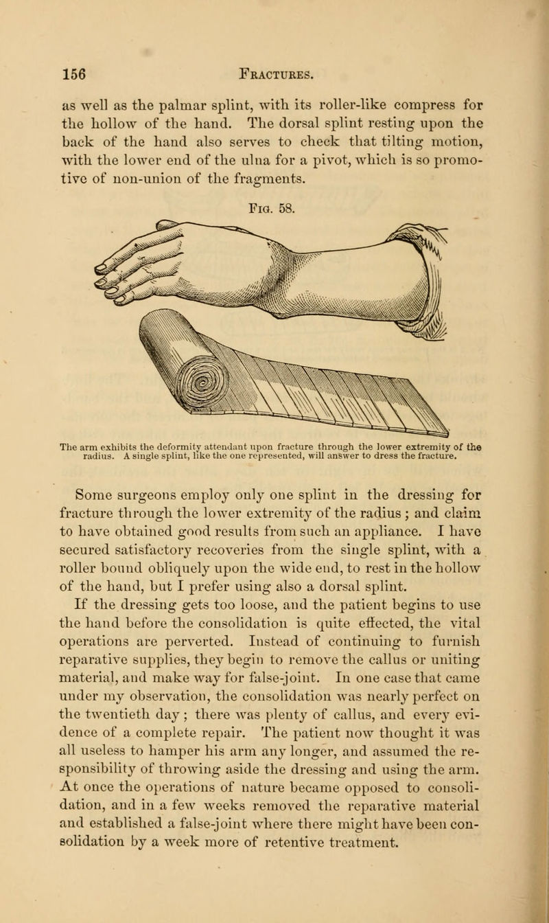 us well as the palmar splint, with its roller-like compress for the hollow of the hand. The dorsal splint resting upon the back of the hand also serves to check that tilting motion, with the lower end of the ulna for a pivot, which is so promo- tive of uon-union of the fragments. Fig. 58. The arm exhibits the deformity attendant upon fracture through the lower extremity of the radius. A single splint, like the one represented, will answer to dress the fracture. Some surgeons employ only one splint in the dressing for fracture through the lower extremity of the radius ; and claim to have obtained good results from such an appliance. I have secured satisfactory recoveries from the single splint, with a roller bound obliquely upon the wide end, to rest in the hollow of the hand, but I prefer using also a dorsal splint. If the dressing gets too loose, and the patient begins to use the hand before the consolidation is quite etfected, the vital operations are perverted. Instead of continuing to furnish reparative supplies, they begin to remove the callus or uniting material, and make way for false-joint. In one case that came under my observation, the consolidation was nearly perfect on the twentieth day ; there was plenty of callus, and every evi- dence of a complete repair. The patient now thought it was all useless to hamper his arm any longer, and assumed the re- sponsibility of throwing aside the dressing and using the arm. At once the operations of nature became opposed to consoli- dation, and in a few weeks removed the reparative material and established a false-joint where there might have been con- solidation by a week more of retentive treatment.