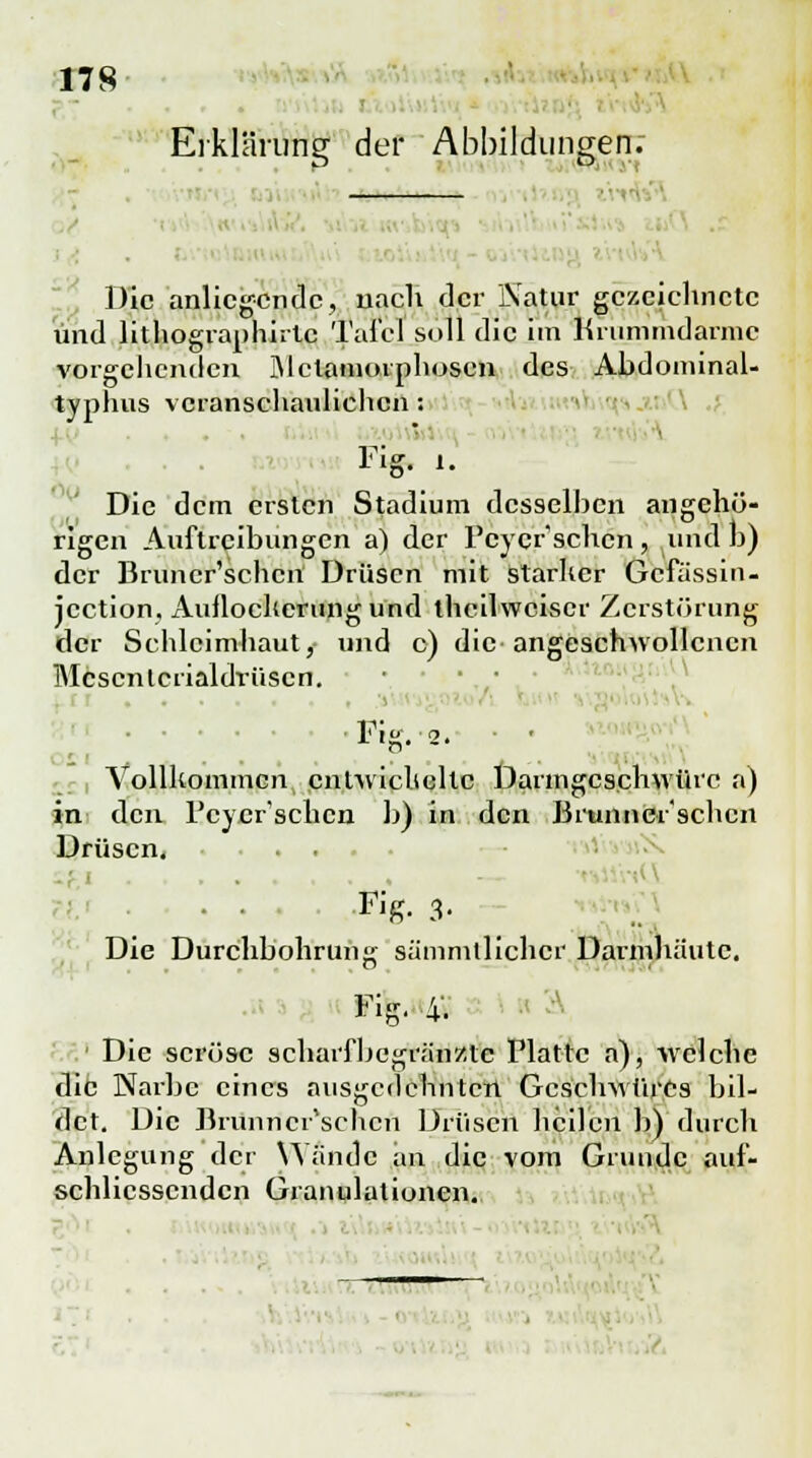 178 Erklärung der Abbildungen; Die anliegende, nach der LVatur gezeichnete und lithographirtc Tai'cl soll die im Ki ummdarmc vorgehenden Metamorphosen des Abdominal- typhus veranschaulichen: Fig. i. Die dem ersten Stadium dcsselhcn angehü- rigen Auftreibungen a) der Pcycrschcn, und h) der Bruncr'schcn Drüsen mit starker Gcfässin- jeetion, Aullocherung und theilweiser Zerstörung der Schleimhaut, und c) die angeschwollenen Mcscnlcrialdvüscn. Vollkommen cnlwicheltc Darmgeschwüre a) in den Fcycr'schcn b) in den Brunner'schcn Drüsen. . . . Fig. 3- Die Durchbohrung sämmtllchcr Darmhaute. Fig. 4* Die seröse scharfbegränzte Platte a), welche die Narbe eines ausgedehnten Geschwüres bil- det. Die Brunncr'schcn Drüsen heilen b) durch Anlegung der Wände an die vom Grunde auf- schlicsscndcn Granulationen. _______