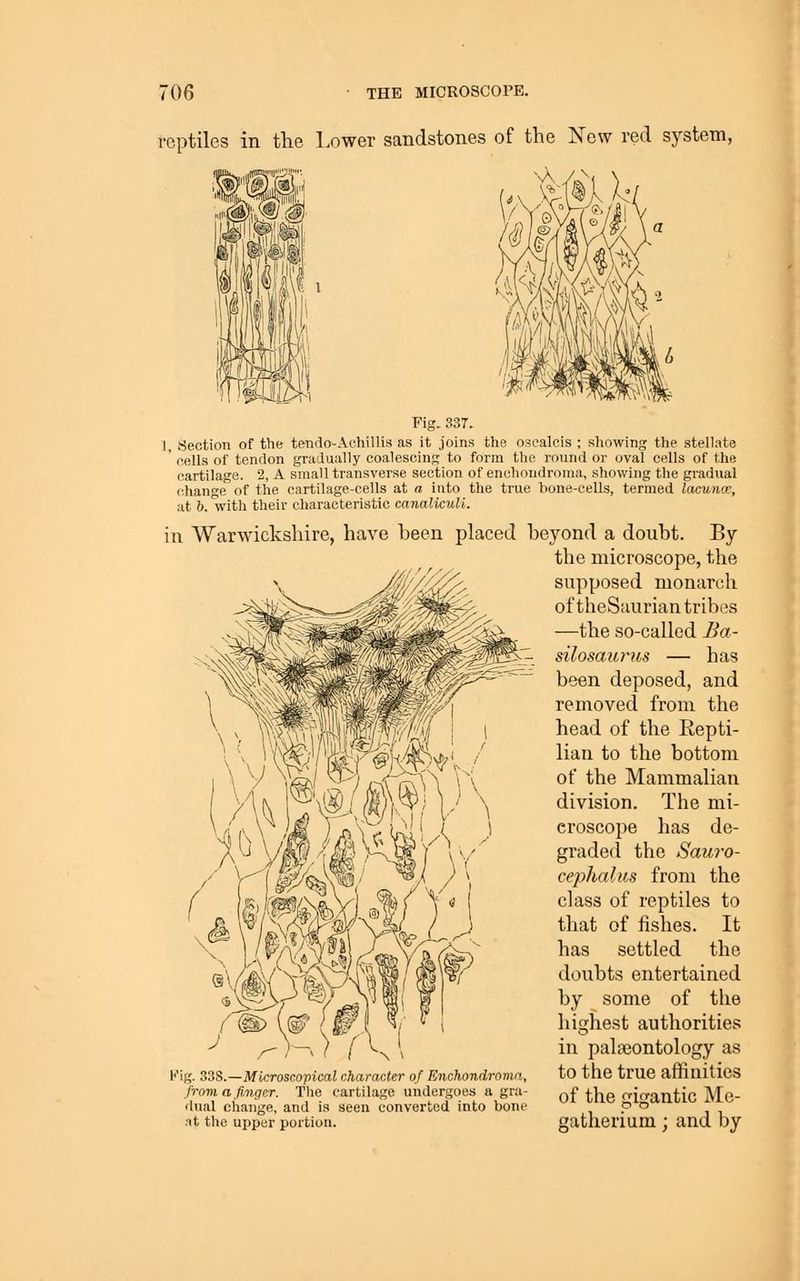 reptiles in the Lower sandstones of the New red system, Fig. 33T. I, Section of the tendo-Achillis as it joins the oscalcis ; showing the stellate ' cells of tendon gradually coalescing to form the round or oval cells of the cartilage. 2, A small transverse section of enchoiidroma, showing the gradual change of the cartilage-cells at a into the true bone-cells, termed lacume, at b.'\vith their characteristic canalicuU. in Warwickshire, have heen placed beyond a doubt. By the microscope, the y^// '/^ supposed monarch of theSaurian tribes —the so-called Ba- silosaurns — has been deposed, and removed from the head of the Eepti- lian to the bottom of the Mammalian division. The mi- croscope has de- graded the Sauro- cephaliis from the class of reptiles to that of fishes. It has settled the doubts entertained by some of the highest authorities in palaeontology as Kig. S3S.—Microscopical character of Enchondroma, tO the true atnillties from a finger. The cartilage undergoes a gra- of the gigantic Mc- dual change, and is seen converted into bone , P ° at the upper portion. gatlierium ; and by