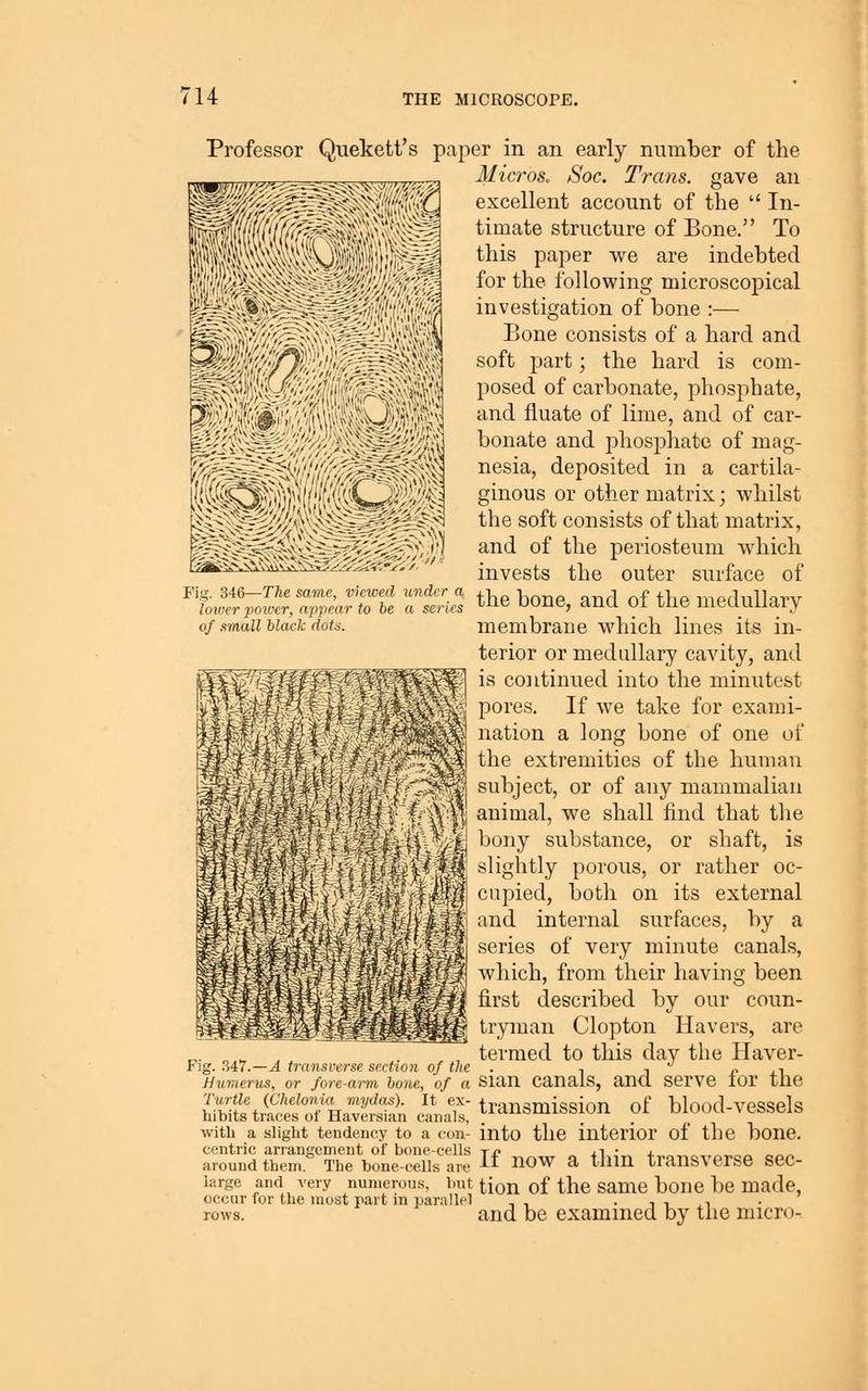 of small black dots. Professor Quekett's paper in an early number of the Micros. Soc. Trans, gave an excellent account of the  In- timate structure of Bone. To this paper we are indebted for the following microscopical investigation of bone :— Bone consists of a hard and soft part; the hard is com- posed of carbonate, phosphate, and fiuate of lime, and of car- bonate and phosphate of mag- nesia, deposited in a cartila- ginous or other matrix; whilst the soft consists of that matrix, and of the periosteum which invests the outer surface of Fig. 346—TTte same, viewed under a .-k i •, n .i ,^Tp(],illqT.v louver poiver, appear to be a serUs '''^ UOne, anci 01 IU.G meciUiJary membrane which lines its in- terior or medullary cavity, and is continued into the minutest pores. If we take for exami- nation a long bone of one of the extremities of the human subject, or of any mammalian animal, we shall find that the bony substance, or shaft, is slightly porous, or rather oc- cupied, both on its external and internal surfaces, by a series of very minute canals, which, from their having been first described by our coun- tryman Clopton Havers, are ^. „ ^ , termed to this day the Haver- F)g. ?.47.—A transverse section of the . , , ^ „ ., Humerus, or fore-arm hone, of a sian canals, and servo lor the hi^^f«%Sof HnvpS , T transmission of blood-vessels nibits traces 01 Haversian canals, with a slight tendency to a con- into the interior of the bone. centric arrangement of bone-cells tj? ^.^ •„ j. . around them The bone-cells are  ^^^ ^ thin traUSVerse SBC- large and very numerous, init ti^n of the Same bone be made, occur for the most part m parallel . , ■ t ^ ,t rows. and be examined by the micro-