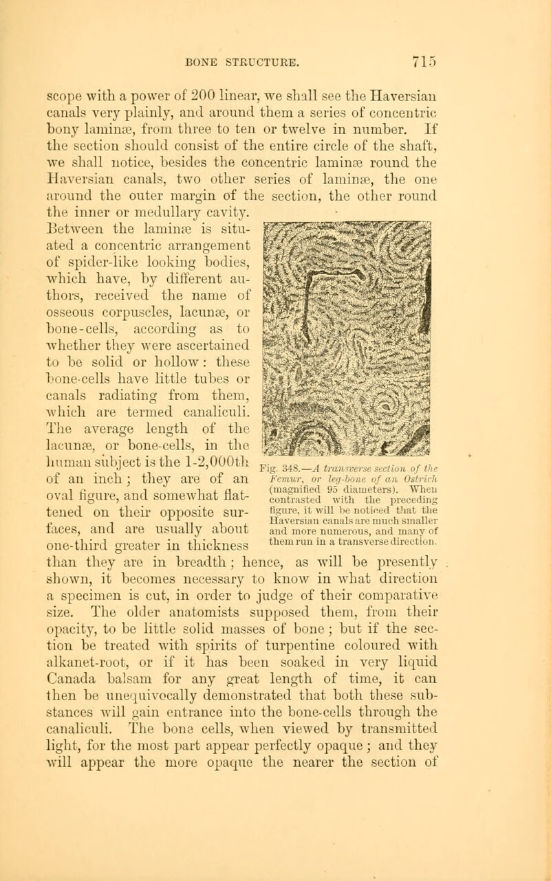 scope with a power of 200 linear, we shall see the Haversian canals very plainly, and around them a series of concentric bony laminpe, from three to ten or twelve in number. If the section should consist of the entire cii'cle of the shaft, we shall notice, besides the concentric laminte round the Haversian canals, two other series of laminte, the one around the outer margin of the section, the otlier round the inner or medulh\ry cavity. Between the laminie is situ- ated a concentric arrangement of spider-like looking bodies, which have, by ditferent au- thors, received the name of osseous corpuscles, lacunae, or bone-cells, according as to whether they were ascertained to be solid or hollow: these bone-cells have little tubes or canals radiating from them, which are termed canaliculi. The average length of the lacunar, or bone-cells, in the liuman siibject is the 1-2,000th of an inch; they are of an oval figure, and somewhat flat- tened on their opposite sur- faces, and are usually about one-third greater in thickness than they are in breadth; hence, as •will be presently shown, it becomes necessary to know in what direction a specimen is cut, in order to judge of their comparative size. The older anatomists supposed them, from their opacity, to be little solid masses of bone; but if the sec- tion be treated with spirits of turpentine coloured with alkanet-root, or if it has been soaked in very liquid Canada balsam for any great length of time, it can then be unequivocally demonstrated that both these sub- stances will gain entrance into the bone-cells through the canaliculi. The bone cells, when viewed by transmitted light, for the most part appear perfectly opaque; and they will appear the more opaque the nearer the section of Fig 34i5—.4 tiaii uisL satioit uf the J'cinuu or leg bone of an Oitnch (magnified 95 diameters) When contrasted with the preceding figure, it will be noticed that the Haversian canals are much smaller and more numerous, and many of them run in a transverse direction.