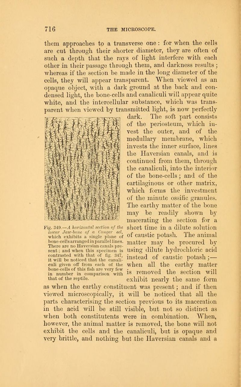 them approaches to a transverse one : for when the cells are cut through their shorter diameter, they are often of such a depth that the rays of light interfere with each other in tlieir passage through them, and darkness results ; whereas if the section be made in the long diameter of the cells, they will appear transparent. When viewed as an opaque object, with a dark ground at the back and con- densed light, the bone-cells and canaliculi will appear quite white, and the intercellular substance, which was trans- parent when viewed by transmitted light, is now perfectly dark. The soft part consists of the periosteum, which in- vest the outer, and of the medullary membrane, which invests the inner surface, lines the Haversian canals, and is continued from them, through the canaliculi, into the inteiior of the bone-cells; and of the cartilaginous or other matrix, which forms the investment of the minute ossific granules. The earthy matter of the bone may be reatiily shown by macerating the section for a short time in a dilute solution of caustic potash. The animal matter may be procured by using dilute hydrochloric acid instead of caustic potash;— when all the earthy matter is removed the section will exhibit nearly the same form as when the earthy constituent was present; and if then viewed microscopically, it will be noticed that all the parts characterising the section previous to its maceration in the acid will be still visible, but not so distinct as when both constitutents were in combination. When, however, the animal matter is removed, the bone will not exhibit the cells and the canaliculi, but is opaque and very brittle, and nothing but the Haversian canals and a Fig. 349.—A horizontal section of the lower Jaw-hone of a Conger eel, which exhibits a single plane of bone-cells arranged in parallel lines. There are no Haveisiancanals pre- sent : and when this specimen is contrasted with that of fig. 347, it will be noticed that the canali- culi given off from each of the bone-cells of this fish are very few in number in comparison with that of the rejitile.