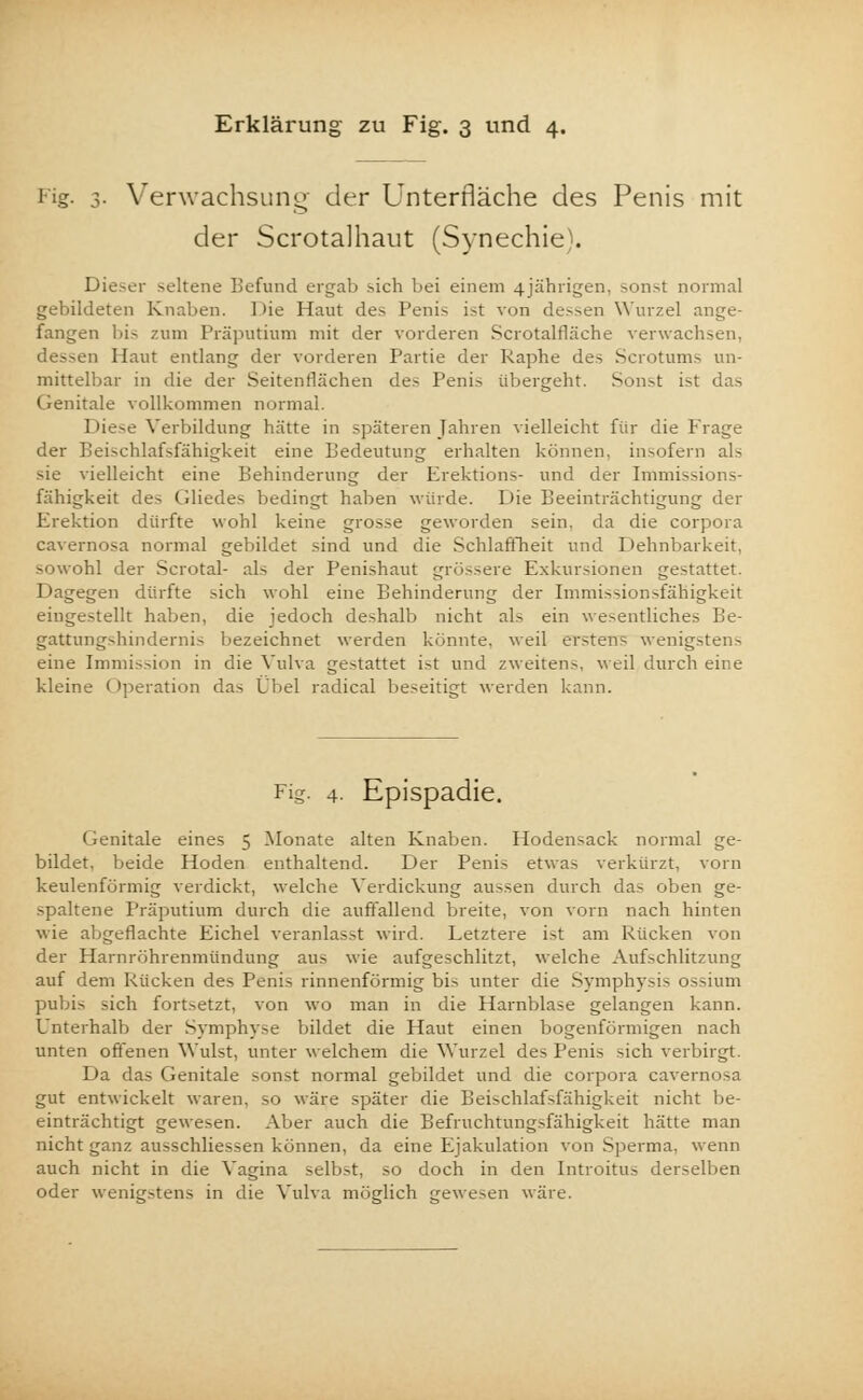 i-i.?- 3- Verwachsung der Unterfläche des Penis mit der Scrotalhaut (Synechie). Dieser seltene Befund ergab sich bei einem 4jährigen, sonst normal gebildeten Knaben. Die Haut des Penis ist von dessen Wurzel ange- fangen bis zum Präputium mit der vorderen Scrotalfläche verwachsen, dessen Haut entlang der vorderen Partie der Raphe des Scrotums un- mittelbar in die der Seitenflächen des Penis übergeht. Sonst ist das Genitale vollkommen normal. Diese Verbildung hätte in späteren Jahren vielleicht für die Präge der Beischlafsfähigkeit eine Bedeutung erhalten können, insofern als sie vielleicht eine Behinderung der Erektions- und der Immissions- fähigkeit des Gliedes bedingt haben würde. Die Beeinträchtigung der Erektion dürfte wohl keine grosse geworden sein, da die corpora cavernosa normal gebildet sind und die Schlaffheit und Dehnbarkeit, sowohl der Scrotal- als der Penishaut grössere Exkursionen gestattet. Dagegen dürfte sich wohl eine Behinderung der Inimissionsfähigkeit eingestellt haben, die jedoch deshalb nicht als ein wesentliches Be- gattungshindernis bezeichnet werden könnte, weil erstens wenigstens eine Immission in die Vulva gestattet ist und zweiten.-, weil durch eine kleine Operation das Übel radical beseitigt werden kann. Fig. 4. Epispadie. Genitale eines 5 Monate alten Knaben. Hodensack normal ge- bildet, beide Hoden enthaltend. Der Penis etwas verkürzt, vorn keulenförmig verdickt, welche Verdickung aussen durch das oben ge- spaltene Präputium durch die auffallend breite, von vorn nach hinten wie abgeflachte Eichel veranlasst wird. Letztere ist am Rücken von der Harnröhrenmündung aus wie aufgeschlitzt, welche Aufschlitzung auf dem Rücken des Penis rinnenförmig bis unter die Symphysis ossium pubis sich fortsetzt, von wo man in die Harnblase gelangen kann. Unterhalb der Symphyse bildet die Haut einen bogenförmigen nach unten offenen Wulst, unter welchem die Wurzel des Penis sich verbirgt. Da das Genitale sonst normal gebildet und die corpora cavernosa gut entwickelt waren, so wäre später die Beischlaf-fähigkeit nicht be- einträchtigt gewesen. Aber auch die Befruchtungsfähigkeit hätte man nicht ganz ausschliessen können, da eine Ejakulation von Sperma, wenn auch nicht in die Vagina selbst, so doch in den Introitus derselben oder wenigstens in die Vulva möglich gewesen wäre.