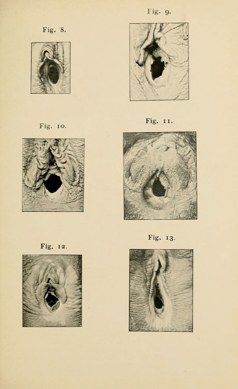 Fig. 8. Fis;. 10. , 7 : s ■ Fig. ii.