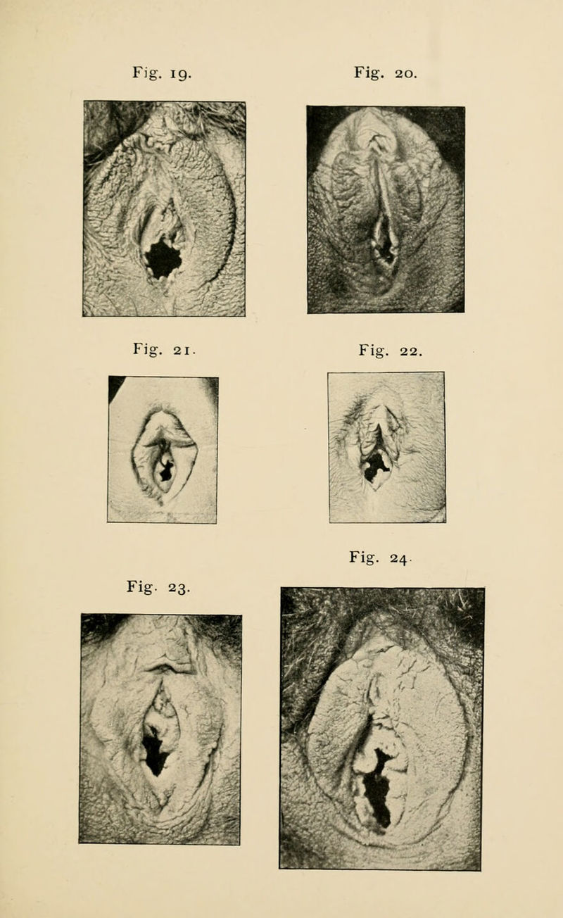 'ZT , ,, i Fig. 21 A 1 Fig. 23. w ••.-,\. ■ Fig. 22.