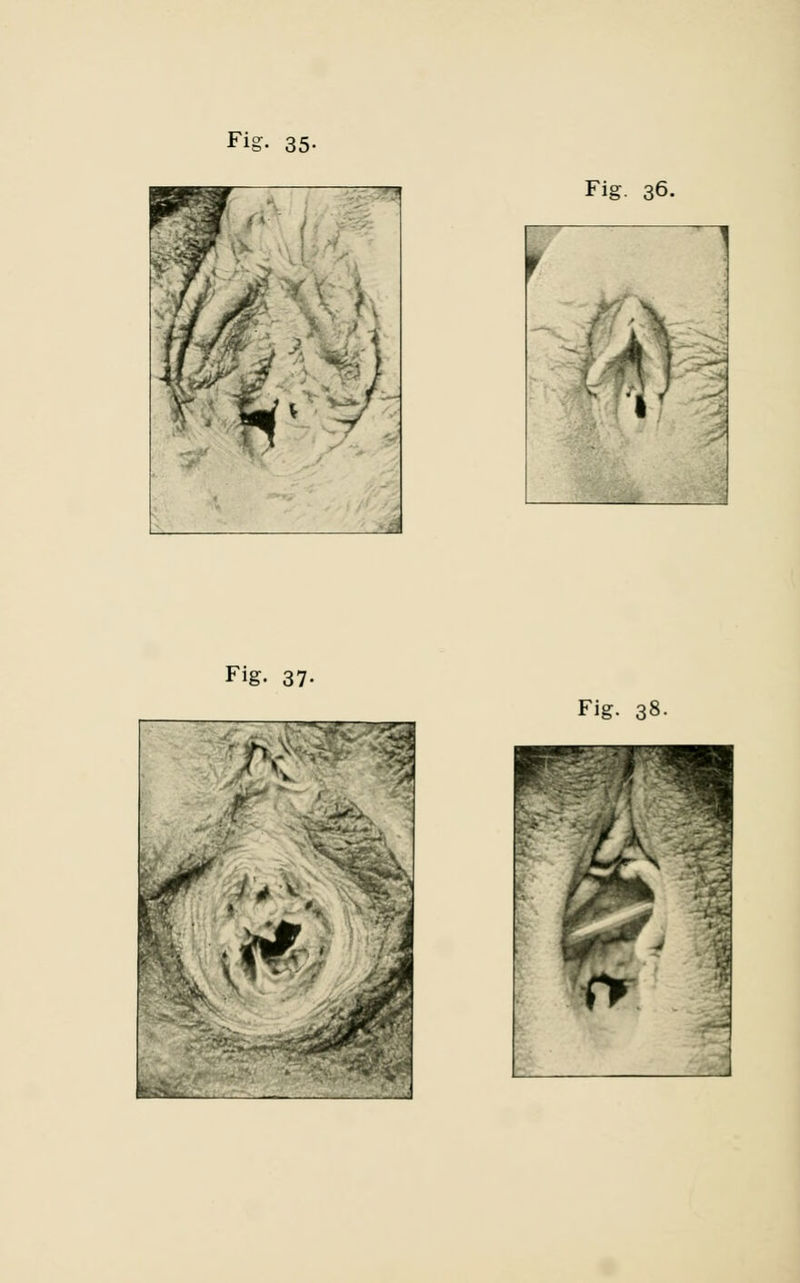 Fig. 36. Fig. 37-