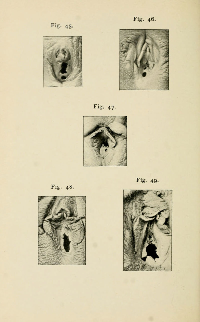 . i Fig. 47-