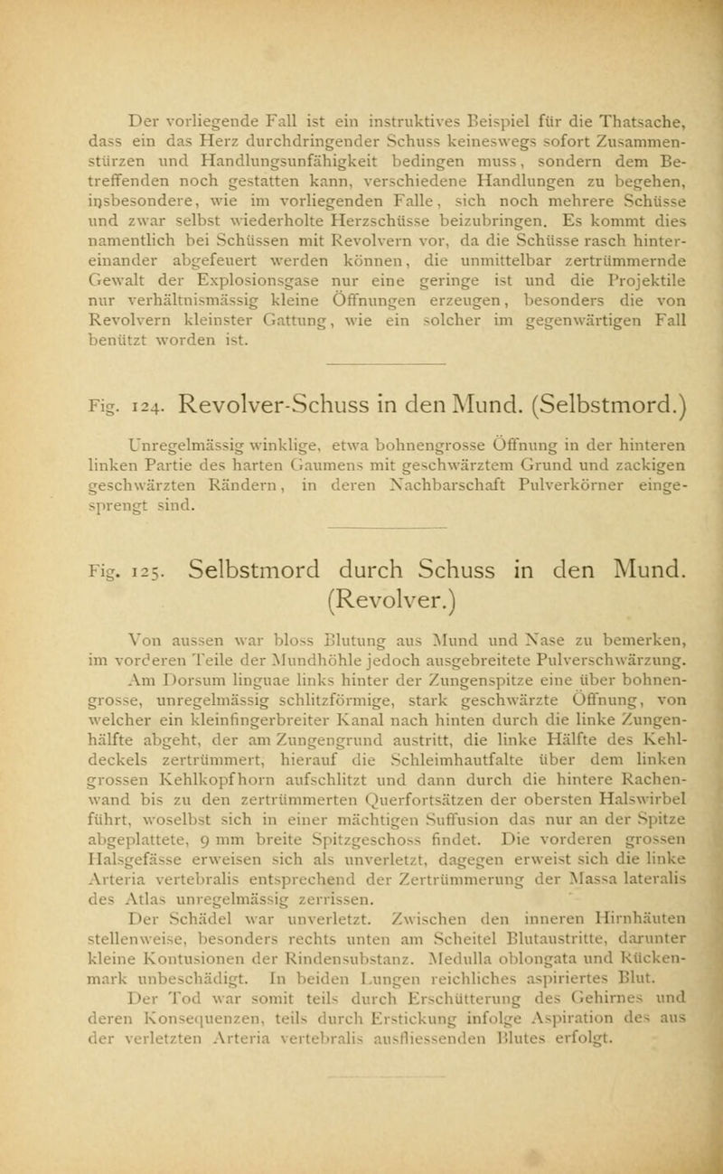 Der vorliegende Fall ist ein instruktives Beispiel für die Thatsache, dass ein das Herz durchdringender Schuss keineswegs sofort Zusammen- stürzen und Handlungsunfähigkeit bedingen muss, sondern dem Be- treffenden noch gestatten kann, verschiedene Handlungen zu begehen, insbesondere, wie im vorliegenden Falle, sich noch mehrere Schüsse und zwar selbst wiederholte Herzschüsse beizubringen. Es kommt dies namentlich bei Schüssen mit Revolvern vor, da die Schüsse rasch hinter- einander abgefeuert werden können, die unmittelbar zertrümmernde Gewalt der Explosionsgase nur eine geringe ist und die Projektile nur verhältnismässig kleine Öffnungen erzeugen, besonders die von Revolvern kleinster Gattung, wie ein solcher im gegenwärtigen Fall benützt worden ist. Fig. 124. Revolver-Schuss in den Mund. (Selbstmord.) Unregelmässig winklige, etwa bohnengrosse Öffnung in der hinteren linken Partie des harten Gaumens mit geschwärztem Grund und zackigen geschwärzten Rändern, in deren Nachbarschaft Pulverkörner einge- sprengt sind. Fig. 125. Selbstmord durch Schuss in den Mund. (Revolver.) Von aussen war bloss Blutung aus Mund und Nase zu bemerken, im vorderen Teile der Mundhöhle jedoch ausgebreitete Pulverschwärzung. Am Dorsum linguae links hinter der Zungenspitze eine über bohnen- grosse, unregelmässig schlitzförmige, stark geschwärzte Öffnung, von welcher ein kleinfingerbreiter Kanal nach hinten durch die linke Zungen- hälfte abgeht, der am Zungengrund austritt, die linke Plälfte des Kehl- deckels zertrümmert, hierauf die Schleimhautfalte über dem linken grossen Kehlkopfhorn aufschlitzt und dann durch die hintere Rachen- wand bis zu den zertrümmerten Querfortsätzen der obersten Halswirbel führt, Woselbst sich in einer mächtigen Suffusion das nur an der Spitze plattete, 9 mm breite Spitzgeschoss findet. Die vorderen grossen Halsgefässe erweisen sich als unverletzt, dagegen erweist sich die linke Arteria vertebralis entsprechend der Zertrümmerung der Mas-a lateralis des Atlas unregelmässig zerrissen. Der Schädel war unverletzt. Zwischen den inneren Hirnhäuten stellenweise, besonders rechts unten am Scheitel Blutaustritte, darunter kleine Kontusionen der Rindensubstanz. Medulla oblongata und kücken- mark unbeschädigt. In beiden Lungen reichliches aspiriertes Blut. Der Tod war somit teil- durch Erschütterung des Gehirnes und deren Konsequenzen, teils durch Erstickung infolge Aspiration des aus erletzten Arteria vertebralis ausfl rfolgt.