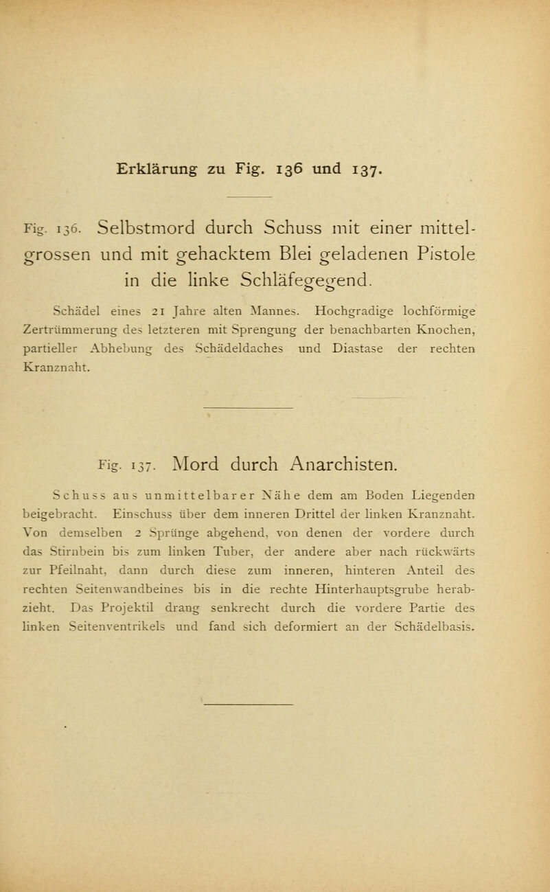 Fig. 136. Selbstmord durch Schuss mit einer mittel- grossen und mit gehacktem Blei geladenen Pistole in die linke Schläfegegend. Schädel eines 21 Jahre alten Mannes. Hochgradige lochförmige Zertrümmerung des letzteren mit Sprengung der benachbarten Knochen, partieller Abhebung des Schädeldaches und Diastase der rechten Kranznaht. Fig. 13-. Mord durch Anarchisten. Schuss aus unmittelbarer Nähe dem am Boden Liegenden beigebracht. Einschuss über dem inneren Drittel der linken Kranznaht. Von demselben 2 Sprünge abgehend, von denen der vordere durch das Stirnbein bis zum linken Tuber, der andere aber nach rückwärts zur Pfeilnaht, dann durch diese zum inneren, hinteren Anteil des rechten Seitenwandbeines bis in die rechte Hinterhauptsgrube herab- zieht. Das Projektil drang senkrecht durch die vordere Partie des linken Seiten Ventrikels und fand sich deformiert an der Schädelbasis.