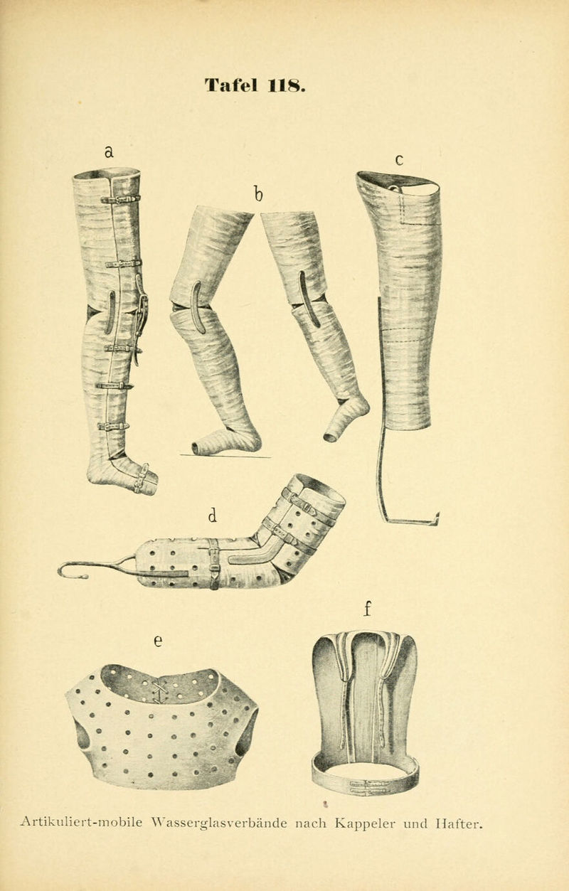 Artikuliert-mobile Wasserglasverbände nach Kappeier und Hafter.