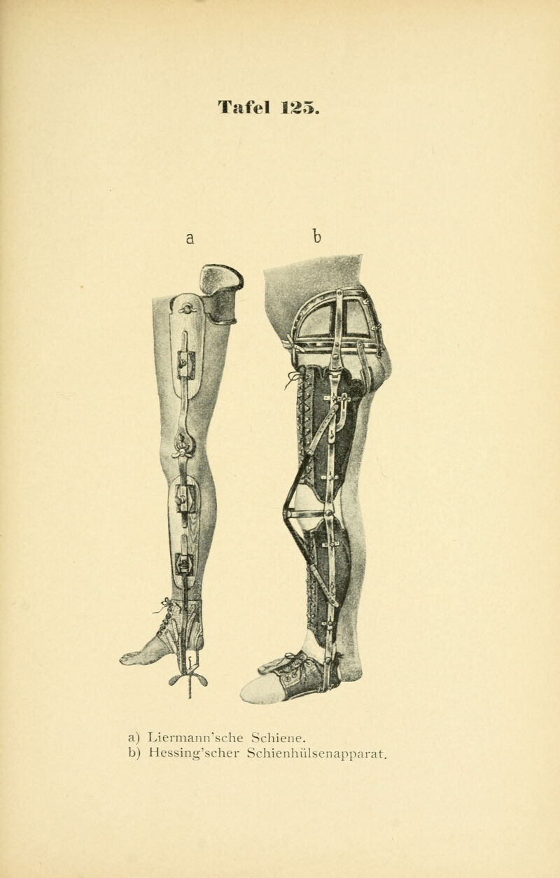 a) Liermann'sche Schiene. b) Hessing'scher Schienhülsenapparat.