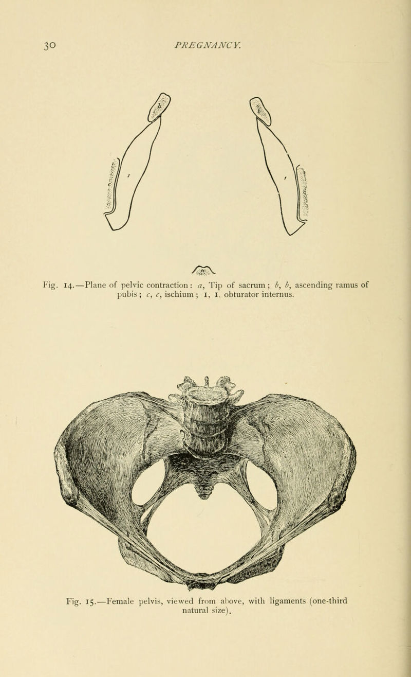 4E\ Fig. 14.—Plane of pelvic contraction: a, Tip of sacrum; b, b, ascending ramus of pubis; c, c, ischium ; I, I. obturator interims. </\% v\ Fig. 15.—Female pelvis, viewed from above, with ligaments (one-third natural size).