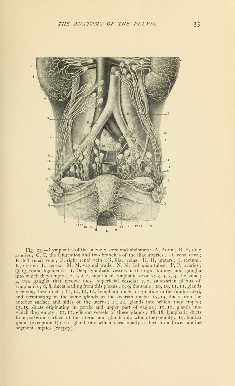 Fig. 23.—Lymphatics of the pelvic viscera and abdomen : A, Aorta ; B, B, iliac arteries; C, C, the bifurcation and two branches of the iliac arteries; D, vena cava; E, left renal vein; F, right renal vein; G, iliac veins; H, H, ureters; I, rectum; K, uterus; L, cervix; M, M, vaginal walls; N, N, Fallopian tubes; P, P, ovaries; Q, Q, round ligaments ; I, Deep lymphatic vessels of the right kidney, and ganglia into which they empty; 2, 2, 2, 2, superficial lymphatic vessels ; 3, 3, 3, 3, the same ; 4, two ganglia that receive these superficial vessels; 7, 7, subovarian plexus of lymphatics ; 8, 8, ducts leading from this plexus ; 9, 9, the same ; 10, 10, 11, 11, glands receiving these ducts ; 12, 12, 12, 12, lymphatic ducts, originating in the fundus uteri, and terminating in the same glands as the ovarian ducts; 13,13, ducts from the anterior surface and sides of the uterus ; 14, 14, glands into which they empty ; 15,15, ducts originating in cervix and upper part of vagina ; 16, 16, glands into which they empty; 17, 17, efferent vessels of these glands; 18, 18, lymphatic ducts from posterior surface of the uterus and glands into which they empty; 19, lumbar gland (exceptional) ; 20, gland into which occasionally a duct frjm lower uterine segment empties (Sappey).