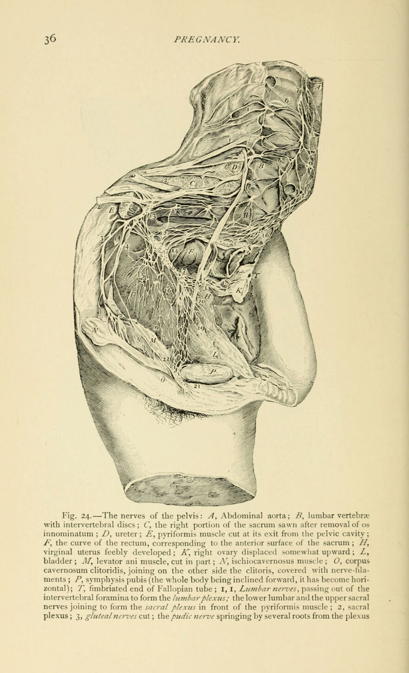 mmj* mmsS Fig. 24.—The nerves of the pelvis: A, Abdominal aorta; B, lumbar vertebra? with intervertebral discs; C, the right portion of the sacrum sawn after removal of os innominatum ; D, ureter; £, pyriformis muscle cut at its exit from the pelvic cavity; F, the curve of the rectum, corresponding to the anterior surface of the sacrum ; H, virginal uterus feebly developed; A~, right ovary displaced somewhat upward ; Z, bladder ; M3 levator ani muscle, cut in part; A', ischiocavernosus muscle ; 0, corpus cavernosum clitoridis, joining on the other side the clitoris, covered with nerve-fila- ments ; P, symphysis pubis (the whole body being inclined forward, it has become hori- zontal); 7\ fimbriated end of Fallopian tube ; I, I, Lumbar nerves, passing out of the intervertebral foramina to form the lumbar plexus: the lower lumbar and the upper sacral nerves joining to form the sacral plexus in front of the pyriformis muscle ; 2, sacral plexus; 3, gluteal nerves cut; the pudic nerve springing by several roots from the plexus
