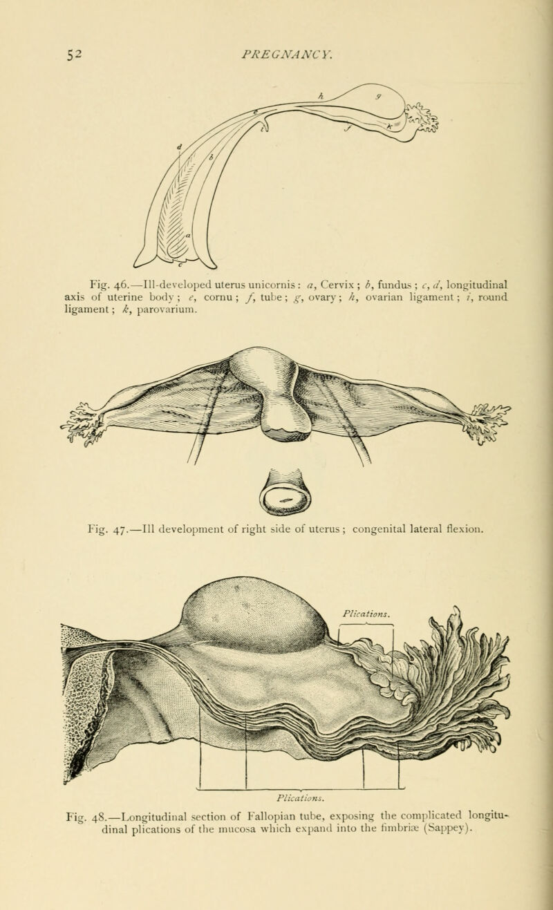 Fig. 46.—Ill-developed uterus unicornis : a, Cervix ; b, fundus ; c, </, longitudinal axis of uterine body ; e, cornu ; f, tube ; g, ovary; //, ovarian ligament; ?', round ligament; k, parovarium. Fig. 47.—111 development of right side of uterus ; congenital lateral flexion. Plications. Fig. 48.—Longitudinal section of Fallopian tube, exposing the complicated longitu- dinal plications of the mucosa which expand into the fimbriae (Sappey).