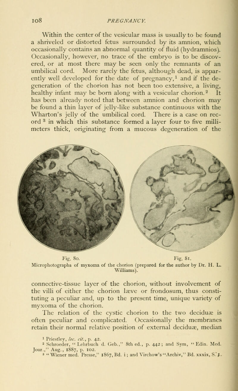 Within the center of the vesicular mass is usually to be found a shriveled or distorted fetus surrounded by its amnion, which occasionally contains an abnormal quantity of fluid (hydramnios). Occasionally, however, no trace of the embryo is to be discov- ered, or at most there may be seen only the remnants of an umbilical cord. More rarely the fetus, although dead, is appar- ently well developed for the date of pregnancy,1 and if the de- generation of the chorion has not been too extensive, a living, healthy infant may be born along with a vesicular chorion.2 It has been already noted that between amnion and chorion may be found a thin layer of jelly-like substance continuous with the Wharton's jelly of the umbilical cord. There is a case on rec- ord 3 in which this substance formed a layer four to five milli- meters thick, originating from a mucous degeneration of the Fig. 80. Fig. 81. Microphotographs of myxoma of the chorion (prepared for the author by Dr. H. L. Williams). connective-tissue layer of the chorion, without involvement of the villi of either the chorion laeve or frondosum, thus consti- tuting a peculiar and, up to the present time, unique variety of myxoma of the chorion. The relation of the cystic chorion to the two deciduae is often peculiar and complicated. Occasionally the membranes retain their normal relative position of external deciduae, median Edin. Med. 1 Priestley, loc. cit., p. 42. 2 Schroeder,  Lehrhuch d. Geb., 8th ed., p. 442; and Sym, Jour., Aug., 1887, p. 102.