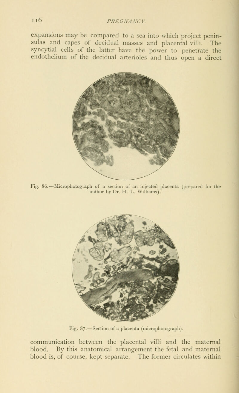 expansions may be compared to a sea into which project penin- sulas and capes of decidual masses and placental villi. The syncytial cells of the latter have the power to penetrate the endothelium of the decidual arterioles and thus open a direct Fig. 86.—Microphotogiaph of a section of an injected placenta (prepared for the author by Dr. H. L. Williams). Fig. 87.—Section of a placenta (microphotogiaph). communication between the placental villi and the maternal blood. By this anatomical arrangement the fetal and maternal blood is, of course, kept separate. The former circulates within