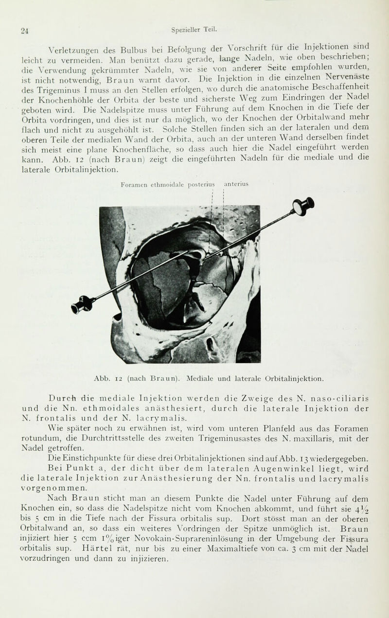 Verletzungen des Bulbus bei Befolsjung der Vorschrift für die Injektionen sind leicht zu vermeiden. Man benützt dazu gerade, lange Nadeln, wie oben beschrieben; die \-erwendung gekrümmter Nadeln, wie sie von anderer Seite empfohlen wurden, ist nicht notwendig, Braun warnt davor. Die Injektion in die einzelnen Nervenaste des Trigeminus I muss an den Stellen erfolgen, wo durch die anatomische Beschaffenheit der Knochenhöhle der Orbita der beste und sicherste Weg zum Eindringen der Nadel geboten wird. Die Nadelspitze muss unter Führung auf dem Knochen in die Tiefe der Orbita vordringen, und dies ist nur da möglich, wo der Knochen der Orbitalwand mehr flach und nicht zu ausgehöhlt ist. Solche Stellen finden sich an der lateralen und dem oberen Teile der medialen Wand der Orbita, auch an der unteren Wand derselben findet sich meist eine plane Knochenfläche, so dass auch hier die Nadel eingeführt werden kann. Abb. 12 (nach Brauni zeigt die eingeführten Nadeln für die mediale und die laterale Orbitalinjektion. Foramen clhnioidale posterius anterius Abb. 12 (nach Braun). Mediale und laterale Orbitalinjcktion. Durch die mediale Injektion werden die Zweige des N. naso-ciliaris und die Nn. ethmoidales anästhesiert, durch die laterale Injektion der N. frontalis und der N. lacrymalis. Wie später noch zu erwähnen ist, wird vom unteren Planfeld aus das Foramen rotundum, die Durchtrittsstelle des zweiten Trigeminusastes des N. maxillaris, mit der Nadel getroffen. Die Einstichpunkte für diese drei Orbitalinjektionen sind auf Abb. 13 wiedergegeben. Bei Punkt a, der dicht über dem lateralen Augenwinkel liegt, wird die laterale Injektion zur Anasthesierung der Nn. frontalis und lacrymalis vorgenommen. Nach Braun sticht man an diesem Punkte die Nadel unter Führung auf dem Knochen ein, so dass die Nadelspitze nicht vom Knochen abkommt, und führt sie 414 bis 5 cm in die Tiefe nach der Fissura orbitalis sup. Dort stösst man an der oberen Orbitalwand an, so dass ein weiteres \'ordnngen der Spitze unmöglich ist. Braun injiziert hier 5 ccm l'^oiger Novokain-Suprareninlösung in der Umgebung der Fiasura orbitalis sup. Härtel rat, nur bis zu einer Maximaltiefe von ca. 3 cm mit der Nadel vorzudringen und dann zu injizieren.