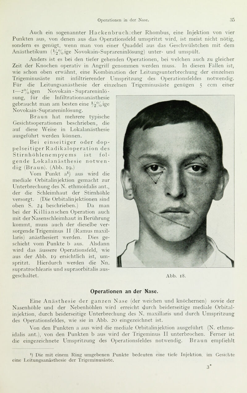 Auch ein sogenannter Hackenbruch;cher Rhombus, eine Injektion von vier Punkten aus, von denen aus das Operationsfeld umspritzt wird, ist meist nicht nötig, sondern es genügt, wenn man von einer Quaddel aus das Geschwülstchen mit dem Anästhetikum (V2%'g6 Novokain-Suprareninlösung) unter- und umspült. Anders ist es bei den tiefer gehenden Operationen, bei welchen auch zu gleicher Zeit der Knochen operativ in Angriff genommen werden muss. In diesen Fällen ist, wie schon oben erwähnt, eine Kombination der Leitungsunterbrechung der einzelnen Trigeminusäste mit infiltrierender Umspritzung des Operationsfeldes notwendig. Für die Leitungsanästhesie der einzelnen Trigeminusäste genügen 5 ccm einer I—2°o igen Novokain - Suprareninlö - sung, für die Infiltrationsanästhesie gebraucht man am besten eine V2%ige Novokain-Suprareninlösung. Braun hat mehrere typische Gesichtsoperationen beschrieben, die auf diese Weise in Lokalanästhesie ausgeführt werden können. Bei einseitiger oder dop- ])elseitiger Radikaloperation des Stirnhöh lene m|)ye ms ist fol- gende Lokalanästhesie not\\'en- dig (Braun). (Abb. 19.) Vom Punkt a^) aus wird die mediale Orbitalinjektion gemacht zur Unterbrechung des N. ethmoidalis ant., der die Schleimhaut der Stirnhöhle versorgt. (Die Orbitalinjektionen sind oben S. 24 beschrieben.) Da man bei der Killi an sehen Operation auch mit der Nasenschleimhaut in Berührung konmit, muss auch der dieselbe ver- sorgende Trigeminus II (Ramus maxil- laris) anästhesiert werden. Dies ge- schieht vom Punkte b aus. Alsdann wird das äussere Operationsfeld, wie aus der Abb. 19 ersichtlich ist, um- spritzt. Hierdurch werden die Nn. supratrochlearis und supraorbitalis aus- geschaltet. Abb. iS. Operationen an der Nase. Eine Anästhesie der ganzen Nase (der weichen und knöchernen) sowie der Nasenhöhle und der Nebenhöhlen wird erreicht durch beiderseitige mediale Orbital- injektion, durch beiderseitige L'nterbrechung des N. maxillaris und durch L-mspritzung des Operationsfeldes, wie sie in Abb. 20 eingezeichnet ist. \'on den Punkten a aus wird die mediale Orbitalinjektion ausgeführt (N. ethmo- idalis ant.), von den Punkten b aus wird der Trigeminus II unterbrochen. Ferner ist die eingezeichnete Umspritzung des Operationsfeldes notwendig. Braun empfiehlt ') Die mit einem Ring umgebenen Punkte bedeuten eine tiefe Injektion im Gesichte eine Leitungsanästhesie der Trigeminusäste.