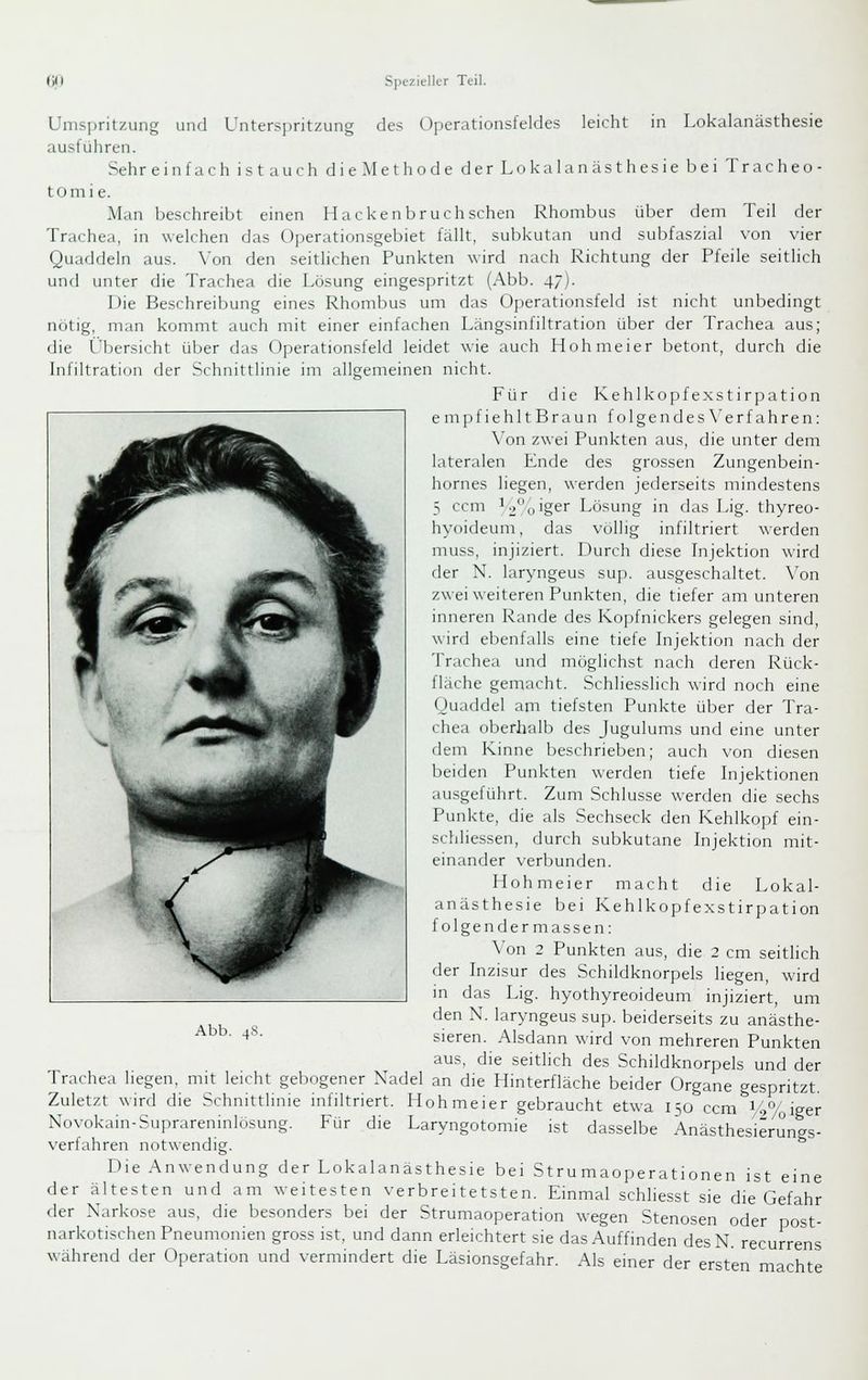 Umspritzung und Untersjiritzung des Operationsfeldes leicht in Lokalanästhesie ausführen. Sehr einfach i s t a u c h d i e M e t h o d e der Lokalanästhesie bei T r a c li e o - tomi e. Man beschreibt einen Hackenbruch sehen Rhombus über dem Teil der Trachea, in welchen das Operationsgebiet fällt, subkutan und subfaszial von vier Quaddeln aus. \'on den seitlichen Punkten wird nach Richtung der Pfeile seitlich und unter die Trachea die Lösung eingespritzt (Abb. 47). Die Beschreibung eines Rhombus um das Operationsfeld ist nicht unbedingt nötig, man kommt auch mit einer einfachen Längsinfiltration über der Trachea aus; die i'bersicht über das Operationsfeld leidet wie auch Hohmeier betont, durch die Infiltration der Schnittlinie im allgemeinen nicht. Für die Kehlkopfexstirpation empfiehlt Braun folgen des \'erfahren: \'on zwei Punkten aus, die unter dem lateralen Ende des grossen Zungenbein- hornes liegen, werden jederseits mindestens 5 ccm '2<jigs'' Lösung in das Lig. thyreo- hyoideum, das völlig infiltriert werden muss, injiziert. Durch diese Injektion wird der N. laryngeus sup. ausgeschaltet. Von zwei weiteren Punkten, die tiefer am unteren inneren Rande des Kopfnickers gelegen sind, wird ebenfalls eine tiefe Injektion nach der Trachea und möglichst nach deren Rück- fläche gemacht. Schliesslich wird noch eine Quaddel am tiefsten Punkte über der Tra- chea oberhalb des Jugulums und eine unter dem Kinne beschrieben; auch von diesen beiden Punkten werden tiefe Injektionen ausgeführt. Zum Schlüsse werden die sechs Punkte, die als Sechseck den Kehlkopf ein- schliessen, durch subkutane Injektion mit- einander verbunden. Hohmeier macht die Lokal- anästhesie bei Kehlkopfexstirpation folgendermassen: \'on 2 Punkten aus, die 2 cm seitlich der Inzisur des Schildknorpels liegen, wird m das Lig. hyothyreoideum injiziert, um den N. laryngeus sup. beiderseits zu anästhe- sieren. Alsdann wird von mehreren Punkten aus, die seitlich des Schildknorpels und der Trachea liegen, mit leicht gebogener Nadel an die Hinterfläche beider Organe gespritzt. Zuletzt wird die Schnittlinie infiltriert. Hohmeier gebraucht etwa 150 ccm i4%iger Novokain-Suprareninlösung. Für die Laryngotomie ist dasselbe Änästhes'ierungs- verfahren notwendig. Die Anwendung der Lokalanästhesie bei Strumaoperationen ist eine der ältesten und am weitesten verbreitetsten. Einmal schliesst sie die Gefahr der Narkose aus, die besonders bei der Strumaoperation wegen Stenosen oder post- narkotischen Pneumonien gross ist. und dann erleichtert sie das Auffinden desN. recurrens während der Operation und vermindert die Läsionsgefahr. Als einer der ersten machte Abb. 4S.