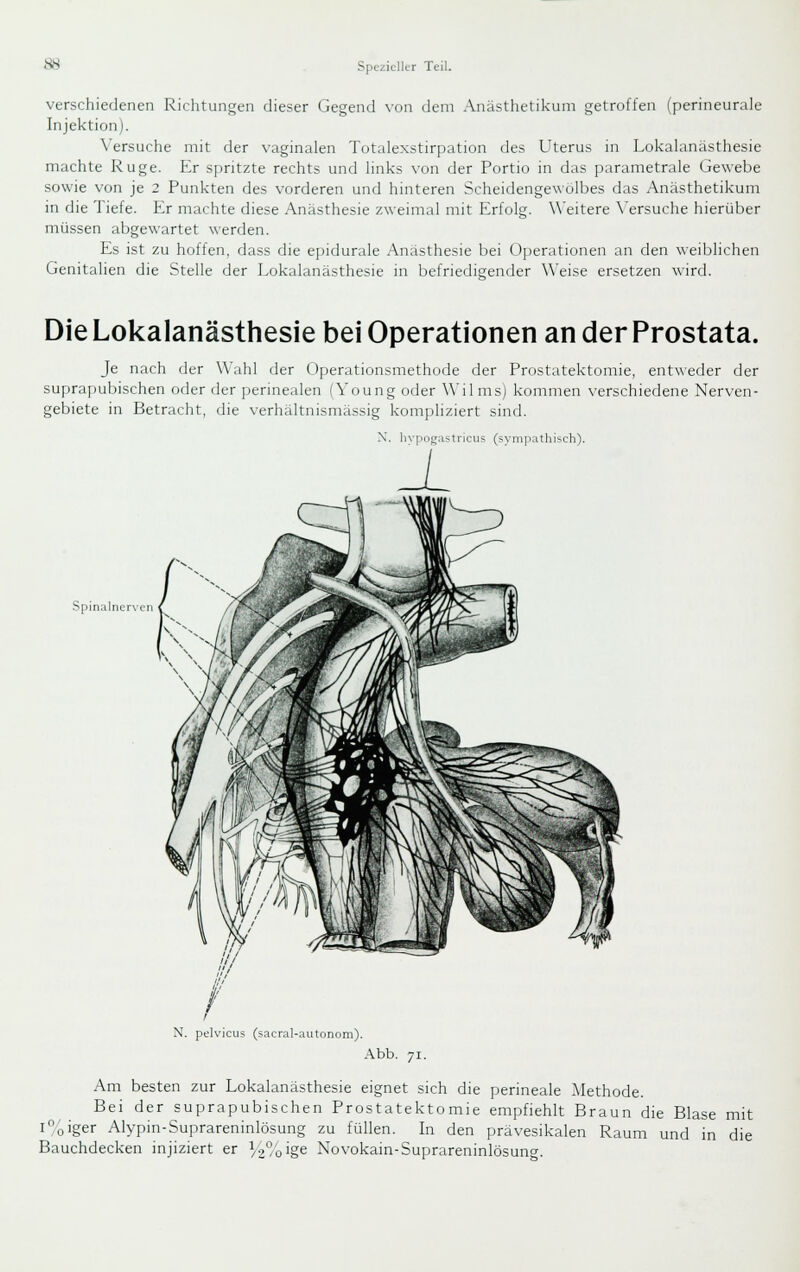 verschiedenen Richtungen dieser Gegend von dem Anästhetikum getroffen (perineurale Injektion). Versuche mit der vaginalen Totalexstirpation des Uterus in Lokahniasthesie machte Rüge. Er spritzte rechts und Hnks von der Portio in das parametrale Gewebe sowie von je 2 Punkten des vorderen und hinteren Scheidengewölbes das Anästhetikum in die Tiefe. Er machte diese Anästhesie zweimal mit Erfolg. Weitere \'ersuche hierüber müssen abgewartet werden. Es ist zu hoffen, dass die epidurale Anästhesie bei Operationen an den weiblichen Genitalien die Stelle der Lokalanästhesie in befriedigender Weise ersetzen wird. Die Lokalanästhesie bei Operationen an der Prostata. Je nach der Wahl der Operationsmethode der Prostatektomie, entweder der suprapubischen oder der perinealen (Young oder Wilms) kommen verschiedene Nerven- gebiete in Betracht, die verhältnismässig kompliziert sind. X. hypogastricus (sympathisch). Spinalncr\'cn N. pelvicus (sacral-autonom). Abb. 71. Am besten zur Lokalanästhesie eignet sich die perineale Alethode. Bei der suprapubischen Prostatektomie empfiehlt Braun die Blase mit l%iger Alypin-Suprareninlösung zu füllen. In den prävesikalen Raum und in die Bauchdecken injiziert er 1/9% ige Novokain-Suprareninlösunc.
