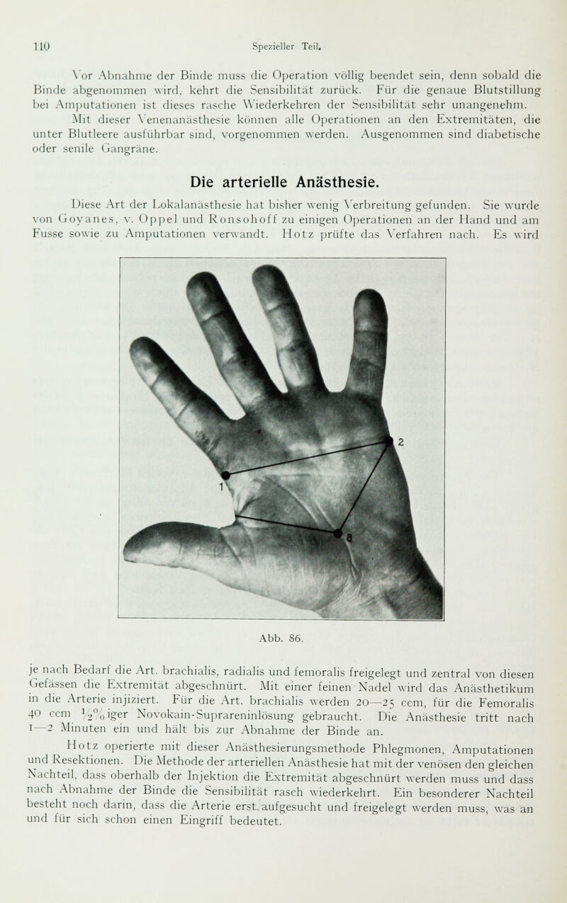 \ or Abnahme der Binde muss die Operation völlig beendet sein, denn sobald die Binde abgenommen wird, kehrt die Sensibilität zurück. Für die genaue Blutstillung bei Amjjutationen ist dieses rasche Wiederkehren der Sensibilität sehr unangenehm. Mit dieser \'enenanasthesie können alle Operationen an den Extremitäten, die unter Blutleere ausführbar sind, vorgenommen werden. Ausgenommen sind diabetische oder senile Gangräne. Die arterielle Anästhesie. Diese Art der Lokalanästhesie hat bisher wenig \'erbreitung gefunden. Sie wurde von Goyanes, v. Oppel und Ronsohoff zu einigen Operationen an der Hand und am Fusse sowie zu Amputationen verwandt. Hotz jirüfte das \'erfahren nach. Es \\ird Abb. 86. je nach Bedarf die Art. brachialis, radialis und femoralis freigelegt und zentral von diesen Gelassen die Extremität abgeschnürt. Mit einer feinen Nadel wird das Anästhetikum m die Arterie injiziert. Für die Art. brachialis werden 20—25 ccm, für die Femorahs 40 com i2o'ger Novokain-Supraremnlösung gebraucht. Die Anästhesie tritt nach 1—2 Minuten ein und hält bis zur Abnahme der Binde an. Hotz operierte mit dieser Anästhesierungsmethode Phlegmonen, Amputationen und Resektionen. Die Methode der arteriellen Anästhesie hat mit der venösen den gleichen Nachteil, dass oberhalb der Injektion die Extremität abgeschnürt werden muss und dass nach Abnahme der Binde die Sensibilität rasch wiederkehrt. Ein besonderer Nachteil besteht noch darin, dass die Arterie erst, aufgesucht und freigelegt werden muss, was an und für sich schon einen Eingriff bedeutet.