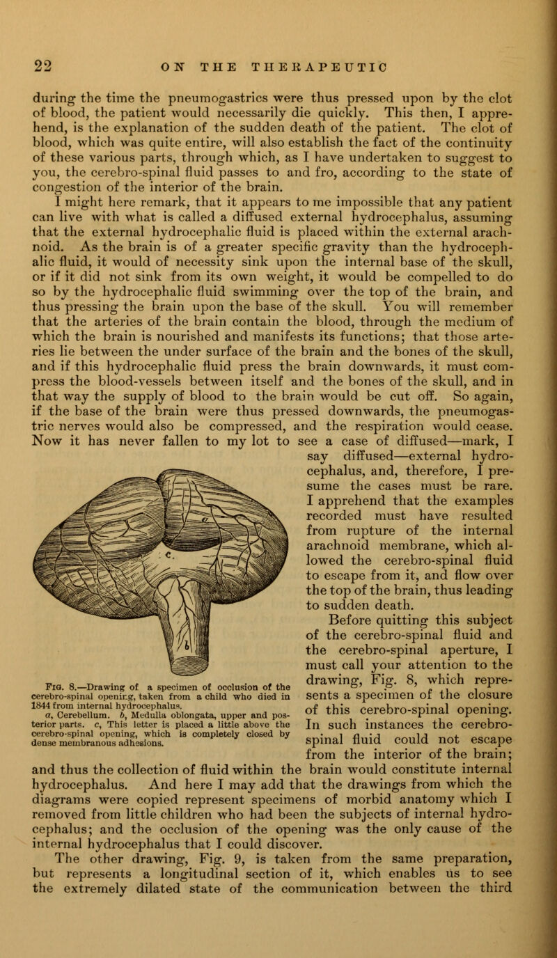 during the time the pneumogastrics were thus pressed upon by the clot of blood, the patient would necessarily die quickly. This then, I appre- hend, is the explanation of the sudden death of the patient. The clot of blood, which was quite entire, will also establish the fact of the continuity of these various parts, through which, as I have undertaken to suggest to you, the cerebro-spinal fluid passes to and fro, according to the state of congestion of the interior of the brain. 1 might here remark, that it appears to me impossible that any patient can live with what is called a diffused external hydrocephalus, assuming that the external hydrocephalic fluid is placed within the external arach- noid. As the brain is of a greater specific gravity than the hydroceph- alic fluid, it would of necessity sink upon the internal base of the skull, or if it did not sink from its own weight, it would be compelled to do so by the hydrocephalic fluid swimming over the top of the brain, and thus pressing the brain upon the base of the skull. You will remember that the arteries of the brain contain the blood, through the medium of which the brain is nourished and manifests its functions; that those arte- ries lie between the under surface of the brain and the bones of the skull, and if this hydrocephalic fluid press the brain downwards, it must com- press the blood-vessels between itself and the bones of the skull, and in that way the supply of blood to the brain would be cut off. So again, if the base of the brain were thus pressed downwards, the pneumogas- tric nerves would also be compressed, and the respiration would cease. Now it has never fallen to my lot to see a case of diffused—mark, I say diffused—external hydro- cephalus, and, therefore, I pre- sume the cases must be rare. I apprehend that the examples recorded must have resulted from rupture of the internal arachnoid membrane, which al- lowed the cerebro-spinal fluid to escape from it, and flow over the top of the brain, thus leading to sudden death. Before quitting this subject of the cerebro-spinal fluid and the cerebro-spinal aperture, I must call your attention to the drawing, Fig. 8, which repre- sents a specimen of the closure of this cerebro-spinal opening. In such instances the cerebro- spinal fluid could not escape from the interior of the brain; and thus the collection of fluid within the brain would constitute internal hydrocephalus. And here I may add that the drawings from which the diagrams were copied represent specimens of morbid anatomy which I removed from little children who had been the subjects of internal hydro- cephalus; and the occlusion of the opening was the only cause of the internal hydrocephalus that I could discover. The other drawing, Fig. 9, is taken from the same preparation, but represents a longitudinal section of it, which enables us to see the extremely dilated state of the communication between the third Fia. 8.—Drawing of a specimen of occlusion of the cerebro-spinal opening, taken from a child who died in 1844 from internal hydrocephalus. a, Cerebellum, b, Medulla oblongata, upper and pos- terior parts, c, This letter is placed a little above the cerebro-spinal opening, which is completely closed by dense membranous adhesions.