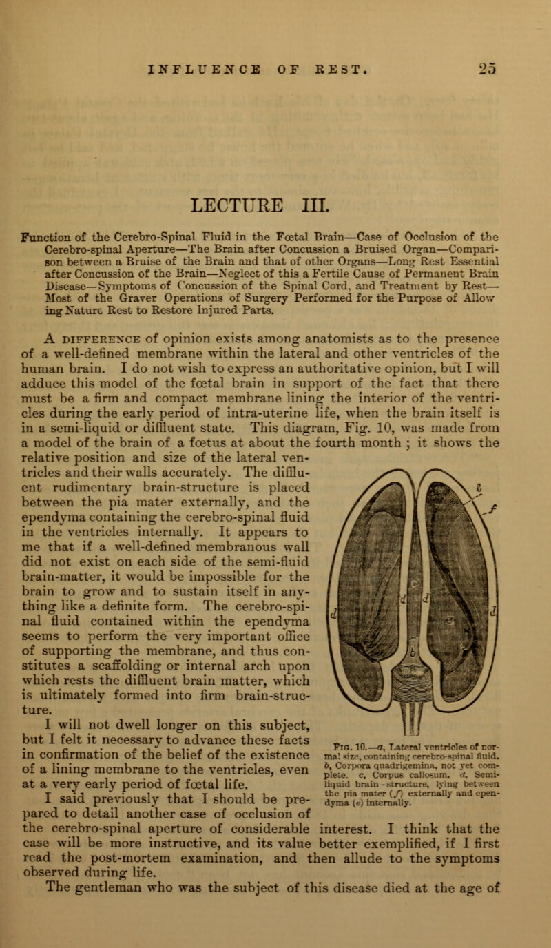 LECTURE III. Function of the Cerebro-Spinal Fluid in the Foetal Brain—Case of Occlusion of the Cerebro-spinal Aperture—The Brain after Concussion a Bruised Organ—Compari- son between a Bruise of the Brain and that of other Organs—Long Rest Essential after Concussion of the Brain—Xeglect of this a Fertile Cause of Permanent Brain Disease—Symptoms of Concussion of the Spinal Cord, and Treatment by Rest— Most of the Graver Operations of Surgery Performed for the Purpose of Allow ing Nature Rest to Restore Injured Parts. A difference of opinion exists among anatomists as to the presence of a well-defined membrane within the lateral and other ventricles of the human brain. I do not wish to express an authoritative opinion, but I will adduce this model of the foetal brain in support of the fact that there must be a firm and compact membrane lining the interior of the ventri- cles during the early period of intra-uterine life, when the brain itself is in a semi-liquid or diffluent state. This diagram, Fig. 10, was made from a model of the brain of a fcetus at about the fourth month ; it shows the relative position and size of the lateral ven- tricles and their walls accurately. The difflu- ent rudimentary brain-structure is placed between the pia mater externally, and the ependyma containing the cerebro-spinal fluid in the ventricles internally. It appears to me that if a well-defined membranous wall did not exist on each side of the semi-fluid brain-matter, it would be impossible for the brain to grow and to sustain itself in any- thing like a definite form. The cerebro-spi- nal fluid contained within the ependyma seems to perform the very important office of supporting the membrane, and thus con- stitutes a scaffolding or internal arch upon which rests the diffluent brain matter, which is ultimately formed into firm brain-struc- ture. I will not dwell longer on this subject, but I felt it necessary to advance these facts in confirmation of the belief of the existence of a lining membrane to the ventricles, even at a very early period of foetal life. I said previously that I should be pre- pared to detail another case of occlusion of the cerebro-spinal aperture of considerable interest. I think that the case will be more instructive, and its value better exemplified, if I first read the post-mortem examination, and then allude to the symptoms observed during life. The gentleman who was the subject of this disease died at the age of Fig. 10.—<7. Lateral ventricles of nor- mal rise, containing cerebro-spinal fluid. 6, Corpora quadrigemina, not yet com- plete, c. Corpus callosum. d. Semi- liquid brain - structure, lying b the pia mater (/) externally and epen- dyma (ej internally.