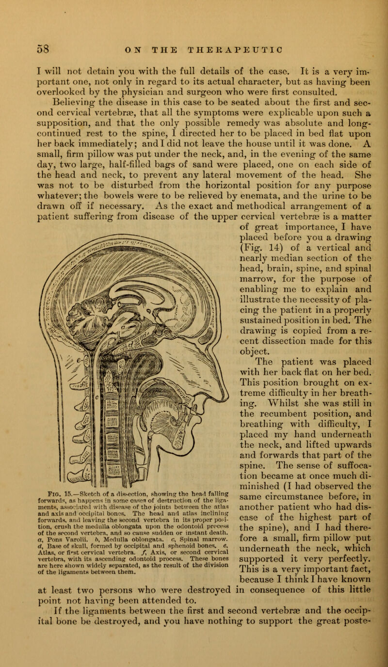 I will not detain you with the full details of the case. It is a very im- portant one, not only in regard to its actual character, but as having been overlooked by the physician and surgeon who were first consulted. Believing the disease in this case to be seated about the first and sec- ond cervical vertebrae, that all the symptoms were explicable upon such a supposition, and that the only possible remedy was absolute and long- continued rest to the spine, I directed her to be placed in bed flat upon her back immediately; and I did not leave the house until it was done. A small, firm pillow was put under the neck, and, in the evening of the same day, two large, half-filled bags of sand were placed, one on each side of the head and neck, to prevent any lateral movement of the head. She was not to be disturbed from the horizontal position for any purpose whatever; the bowels were to be relieved by enemata, and the urine to be drawn off if necessary. As the exact and methodical arrangement of a patient suffering from disease of the upper cervical vertebrae is a matter of great importance, I have placed before you a drawing (Fig. 14) of a vertical and nearly median section of the head, brain, spine, and spinal marrow, for the purpose of enabling me to explain and illustrate the necessity of pla- cing the patient in a properly sustained position in bed. The drawing is copied from a re- cent dissection made for this object. The patient was placed with her back flat on her bed. This position brought on ex- treme difficulty in her breath- ing. Whilst she was still in the recumbent position, and breathing with difficulty, I placed my hand underneath the neck, and lifted upwards and forwards that part of the spine. The sense of suffoca- tion became at once much di- minished (I had observed the same circumstance before, in another patient who had dis- ease of the highest part of the spine), and I had there- fore a small, firm pillow put underneath the neck, which supported it very perfectly. This is a very important fact, because I think I have known at least two persons who were destroyed in consequence of this little point not having been attended to. If the ligaments between the first and second vertebrae and the occip- ital bone be destroyed, and you have nothing to support the great poste- FiG. 15.—Sketch of a dissection, showing the head falling forwards, as happens in some cases of destruction of the liga- ments, associated with disease of the joints between the atlas and axis and occipital bones. The head and atlas inclining forwards, and leaving the second vertebra in its proper posi- tion, crush the medulla oblongata upon the odontoid process of the second vertebra, and so cause sudden or instant death, a, Pons Varolii, b, Medulla oblongata, c, Spinal marrow. d, Base of skull, formed by occipital and sphenoid bones, e. Atlas, or fi*-st cervical vertebra. /, Axis, or second cervical vertebra, with its ascending odontoid process. These bones are here shown widely separated, as the result of the division of the ligamentR between them.