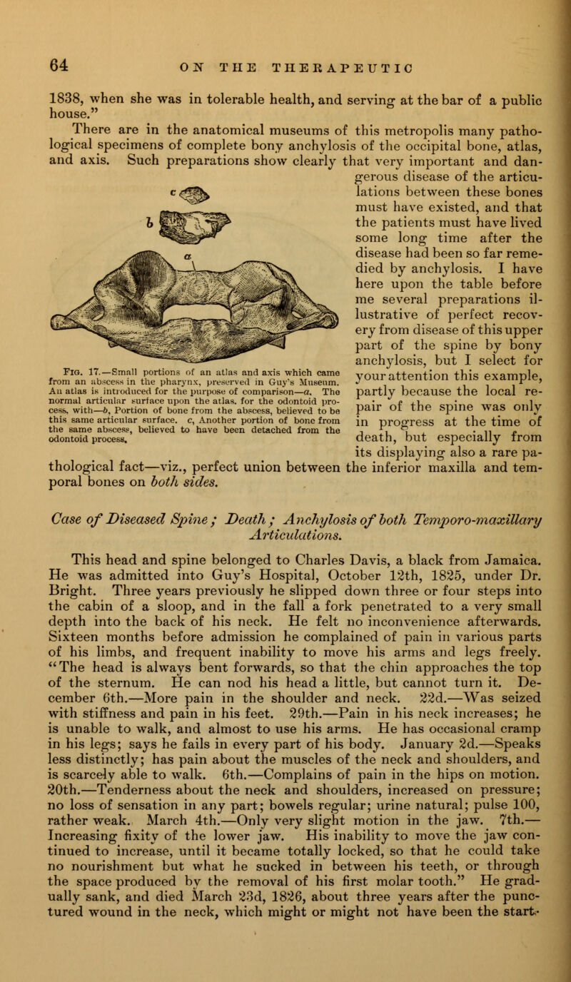 1838, when she was in tolerable health, and serving at the bar of a public house. There are in the anatomical museums of this metropolis many patho- logical specimens of complete bony anchylosis of the occipital bone, atlas, and axis. Such preparations show clearly that very important and dan- gerous disease of the articu- lations between these bones must have existed, and that the patients must have lived some long time after the disease had been so far reme- died by anchylosis. I have here upon the table before me several preparations il- lustrative of perfect recov- ery from disease of this upper part of the spine by bony anchylosis, but I select for your attention this example, partly because the local re- pair of the spine was only in progress at the time of death, but especially from its displaying also a rare pa- thological fact—viz., perfect union between the inferior maxilla and tem- poral bones on both sides. Fig. 17.—Small portions of an atlas and axis which came from an abscess in the pharynx, preserved in Guy's Museum. An atlas is introduced for the purpose of comparison—a. The normal articular surface upon the atlas, for the odontoid pro- cess, with—b, Portion of bone from the abscess, believed to be this same articular surface, c, Another portion of bone from the same abscess, believed to have been detached from the odontoid process. Case of Diseased Spine ; Death; Anchylosis of both Temporo-maxillary Articulations. This head and spine belonged to Charles Davis, a black from Jamaica. He was admitted into Guy's Hospital, October 12th, 1825, under Dr. Bright. Three years previously he slipped down three or four steps into the cabin of a sloop, and in the fall a fork penetrated to a very small depth into the back of his neck. He felt no inconvenience afterwards. Sixteen months before admission he complained of pain in various parts of his limbs, and frequent inability to move his arms and legs freely. The head is always bent forwards, so that the chin approaches the top of the sternum. He can nod his head a little, but cannot turn it. De- cember 6th.—More pain in the shoulder and neck. 22d.—Was seized with stiffness and pain in his feet. 29th.—Pain in his neck increases; he is unable to walk, and almost to use his arms. He has occasional cramp in his legs; says he fails in every part of his body. January 2d.—Speaks less distinctly; has pain about the muscles of the neck and shoulders, and is scarcely able to walk. 6th.—Complains of pain in the hips on motion. 20th.—Tenderness about the neck and shoulders, increased on pressure; no loss of sensation in any part; bowels regular; urine natural; pulse 100, rather weak. March 4th.—Only very slight motion in the jaw. 7th.— Increasing fixity of the lower jaw. His inability to move the jaw con- tinued to increase, until it became totally locked, so that he could take no nourishment but what he sucked in between his teeth, or through the space produced by the removal of his first molar tooth. He grad- ually sank, and died March 23d, 1826, about three years after the punc- tured wound in the neck, which might or might not have been the start-