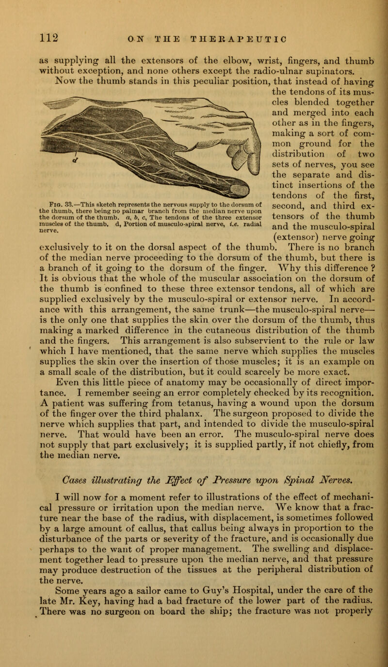 Fig. 33.—This sketch represents the nervous supply to the dorsum of the thumb, there being no palmar branch from the median nerve upon the dorsum of the thumb, a, 6, c, The tendons of the three extensor muscles of the thumb, d, Portion of musculo-spiral nerve, i.e. radial nerve. as supplying all the extensors of the elbow, wrist, fingers, and thumb without exception, and none others except the radio-ulnar supinators. Now the thumb stands in this peculiar position, that instead of having the tendons of its mus- cles blended together and merged into each other as in the fingers, making a sort of com- mon ground for the distribution of two sets of nerves, you see the separate and dis- tinct insertions of the tendons of the first, second, and third ex- tensors of the thumb and the musculo-spiral (extensor) nerve going exclusively to it on the dorsal aspect of the thumb. There is no branch of the median nerve proceeding to the dorsum of the thumb, but there is a branch of it going to the dorsum of the finger. Why this difference ? It is obvious that the whole of the muscular association on the dorsum of the thumb is confined to these three extensor tendons, all of which are supplied exclusively by the musculo-spiral or extensor nerve. In accord- ance with this arrangement, the same trunk—the musculo-spiral nerve— is the only one that supplies the skin over the dorsum of the thumb, thus making a marked difference in the cutaneous distribution of the thumb and the fingers. This arrangement is also subservient to the rule or law which I have mentioned, that the same nerve which supplies the muscles supplies the skin over the insertion of those muscles; it is an example on a small scale of the distribution, but it could scarcely be more exact. Even this little piece of anatomy may be occasionally of direct impor- tance. I remember seeing an error completely checked by its recognition. A patient was suffering from tetanus, having a wound upon the dorsum of the finger over the third phalanx. The surgeon proposed to divide the nerve which supplies that part, and intended to divide the musculo-spiral nerve. That would have been an error. The musculo-spiral nerve does not supply that part exclusively; it is supplied partly, if not chiefly, from the median nerve. Cases illustrating the Effect of Pressure upon Spinal JVerves. I will now for a moment refer to illustrations of the effect of mechani- cal pressure or irritation upon the median nerve. We know that a frac- ture near the base of the radius, with displacement, is sometimes followed by a large amount of callus, that callus being always in proportion to the disturbance of the parts or severity of the fracture, and is occasionally due perhaps to the want of proper management. The swelling and displace- ment together lead to pressure upon the median nerve, and that pressure may produce destruction of the tissues at the peripheral distribution of the nerve. Some years ago a sailor came to Guy's Hospital, under the care of the late Mr. Key, having had a bad fracture of the lower part of the radius. There was no surgeon on board the ship; the fracture was not properly